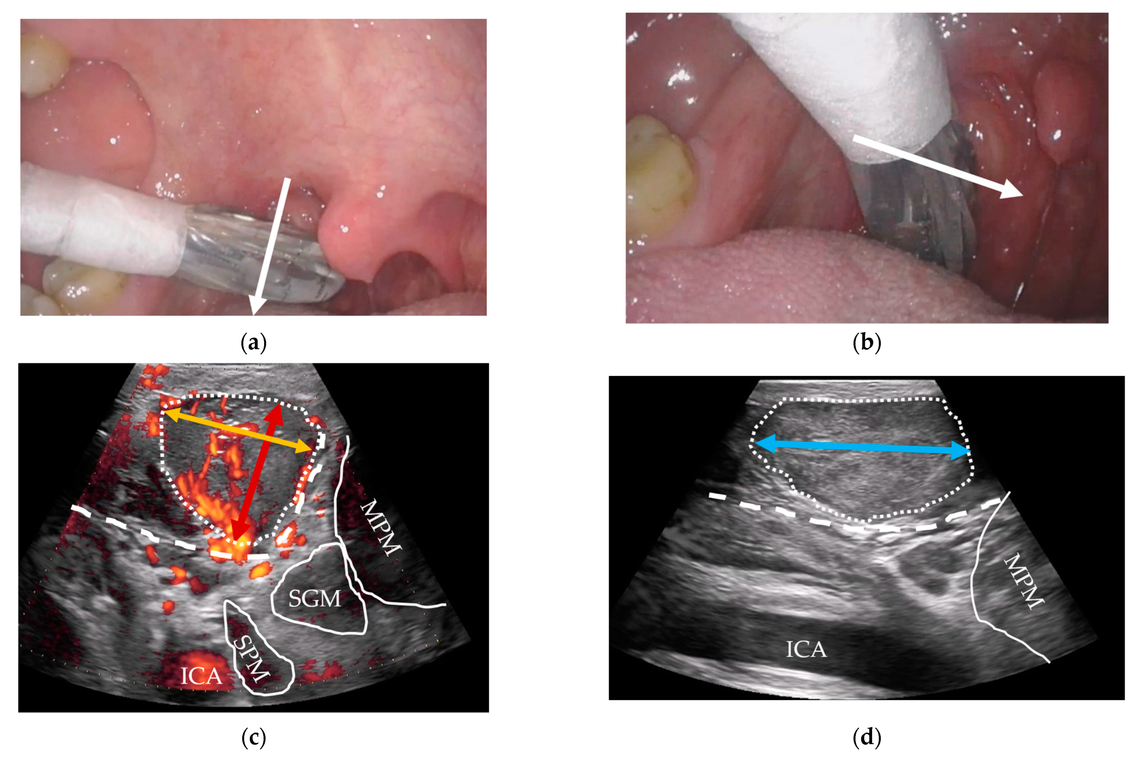 Diagnostics 14 00577 g001