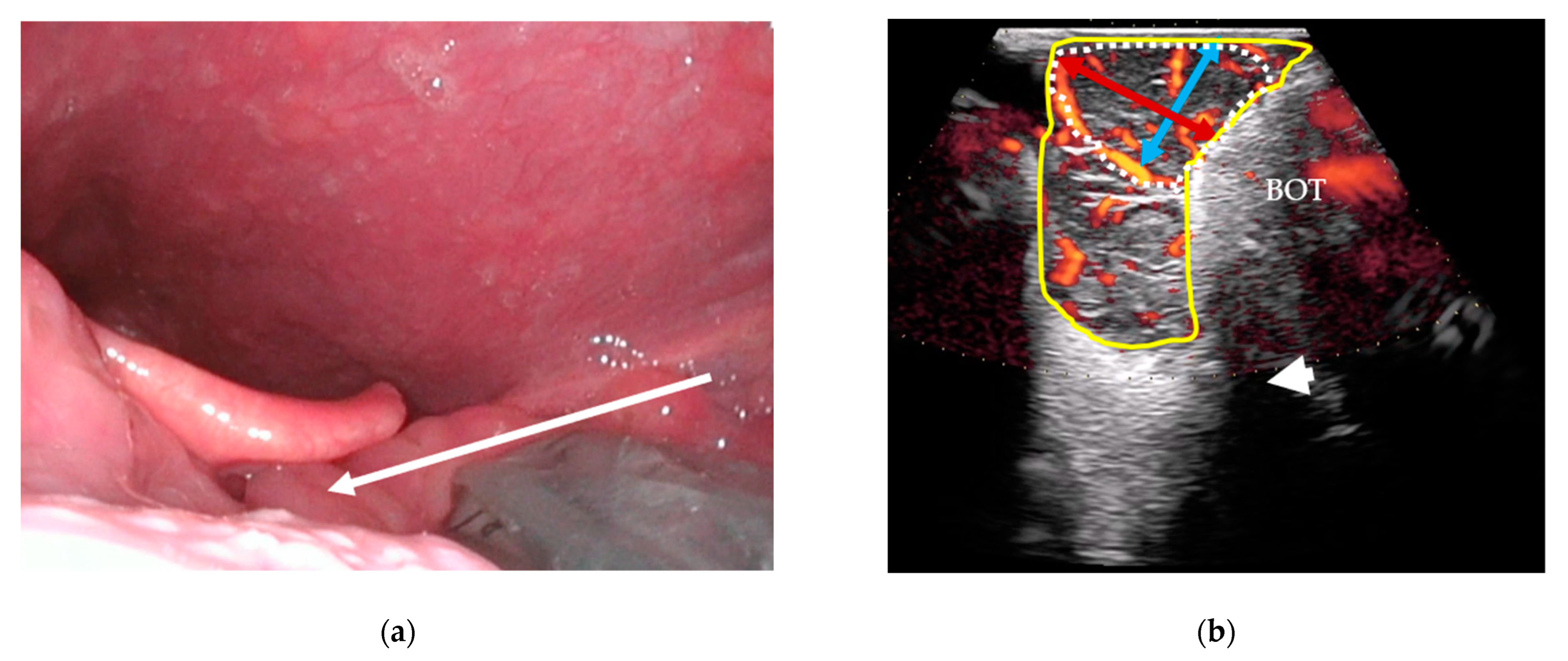 Diagnostics 14 00577 g002