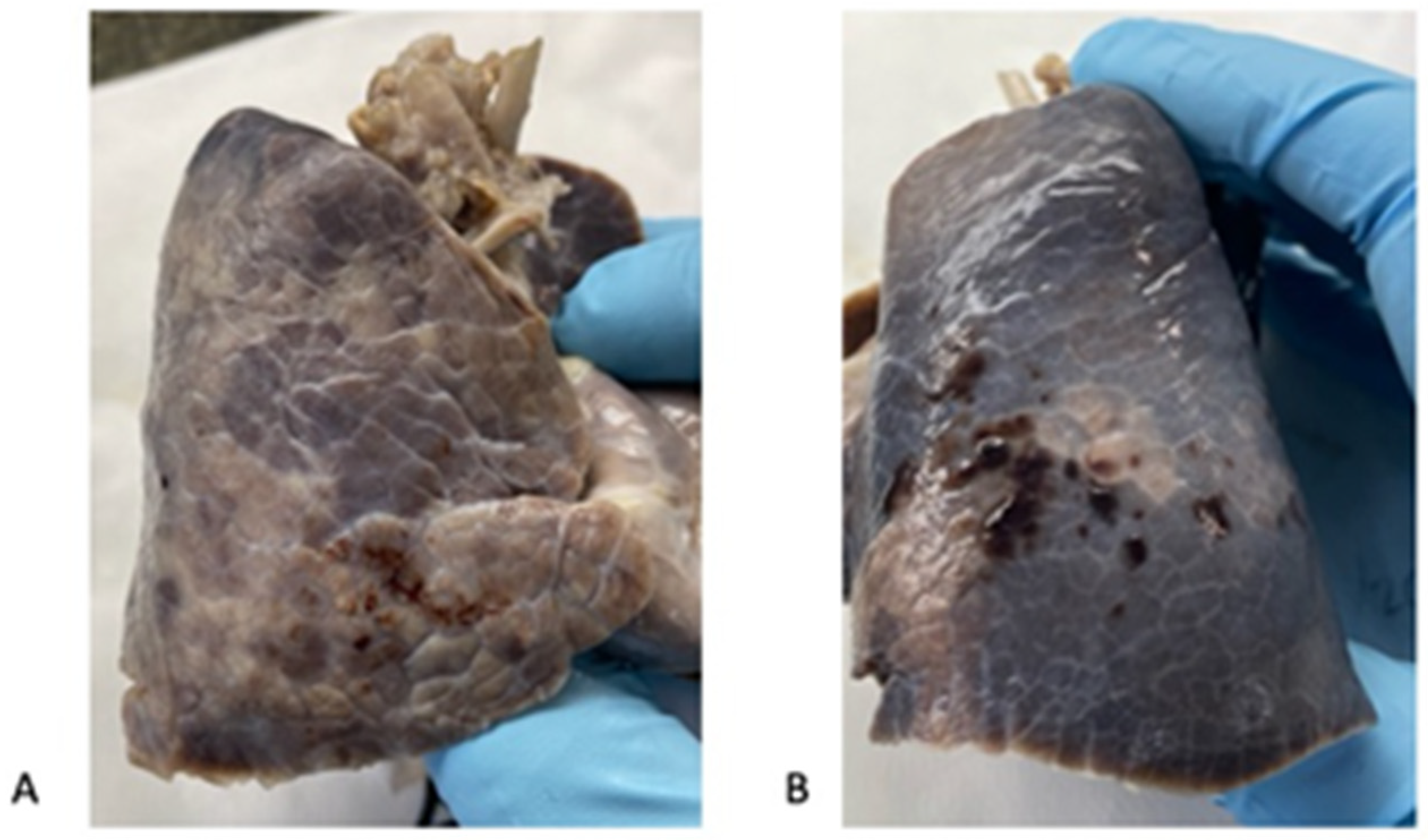 Diagnostics 14 00601 g002 Diagnostics 14 00601 g002