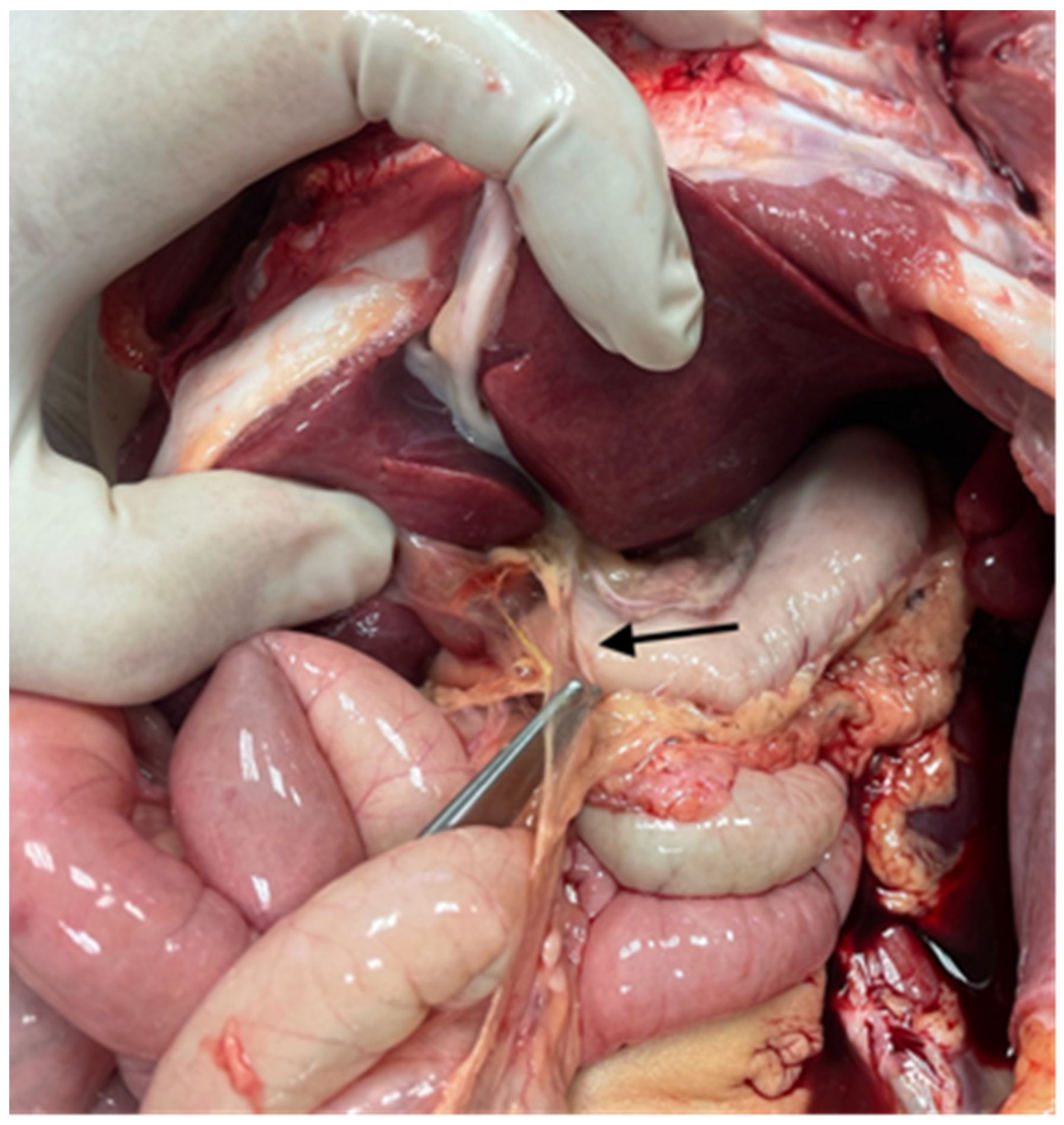 Diagnostics 14 00601 g004 Diagnostics 14 00601 g004