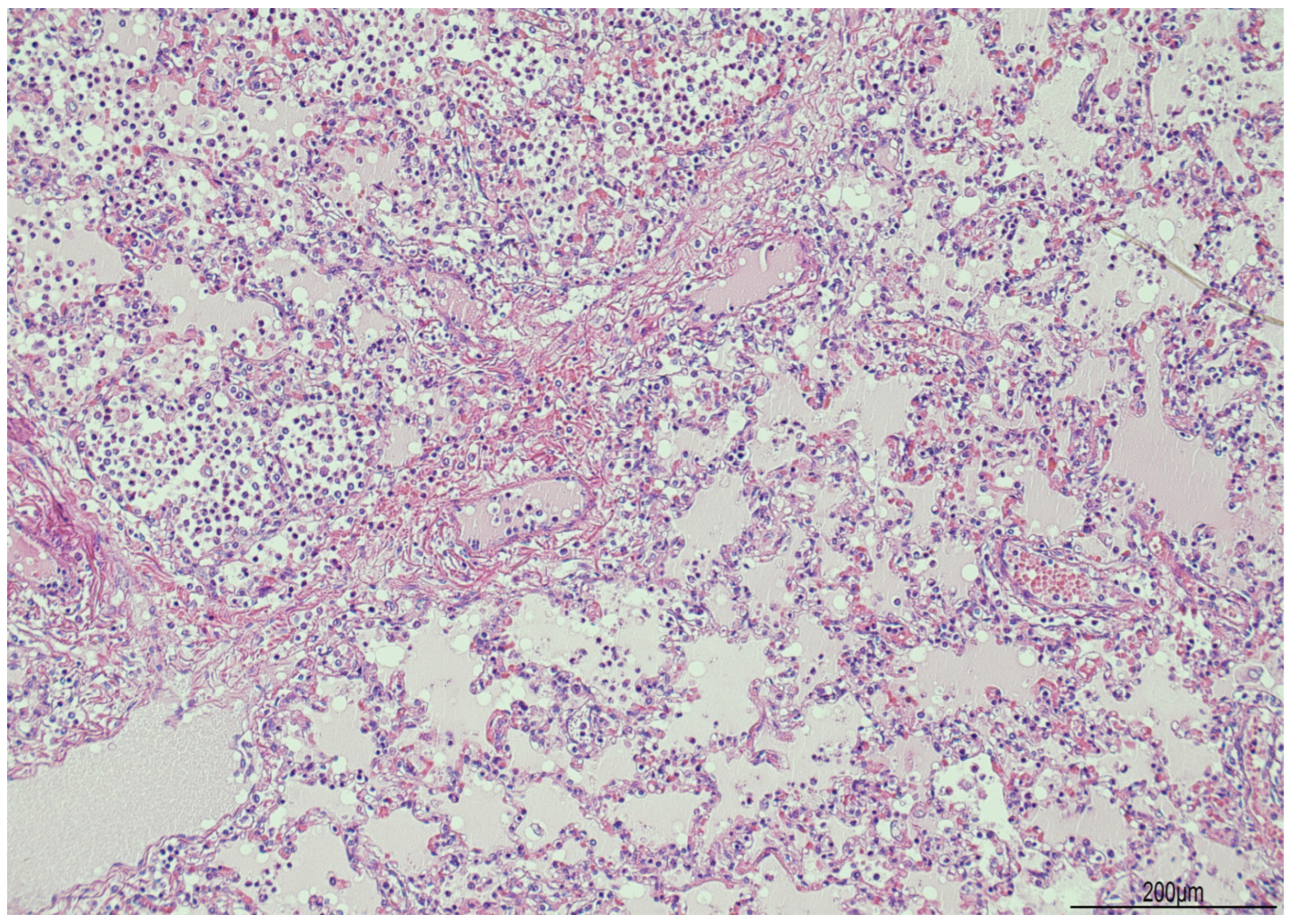 Diagnostics 14 00601 g007 Diagnostics 14 00601 g007