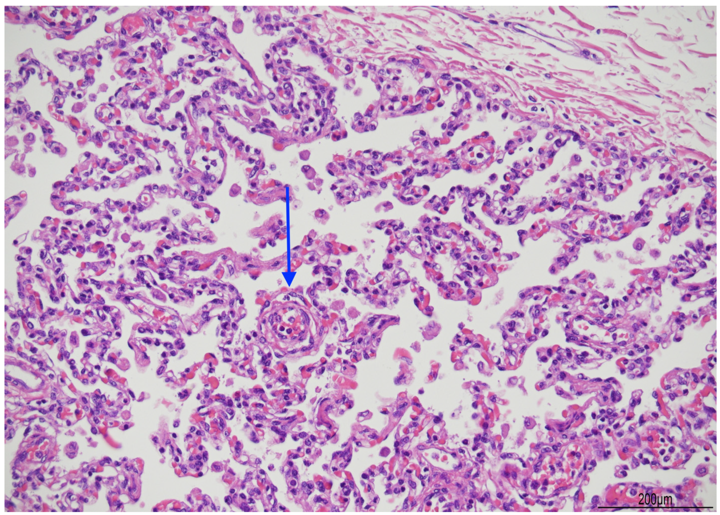 Diagnostics 14 00601 g008 Diagnostics 14 00601 g008