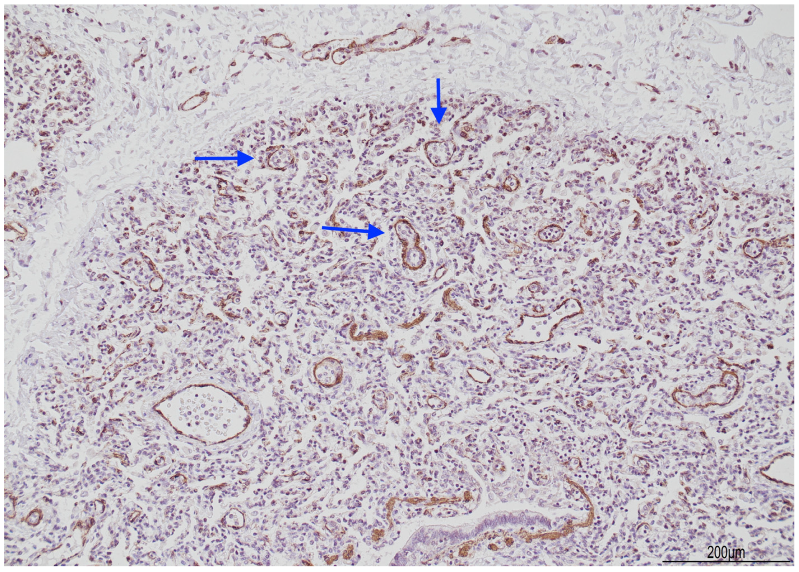 Diagnostics 14 00601 g009 Diagnostics 14 00601 g009