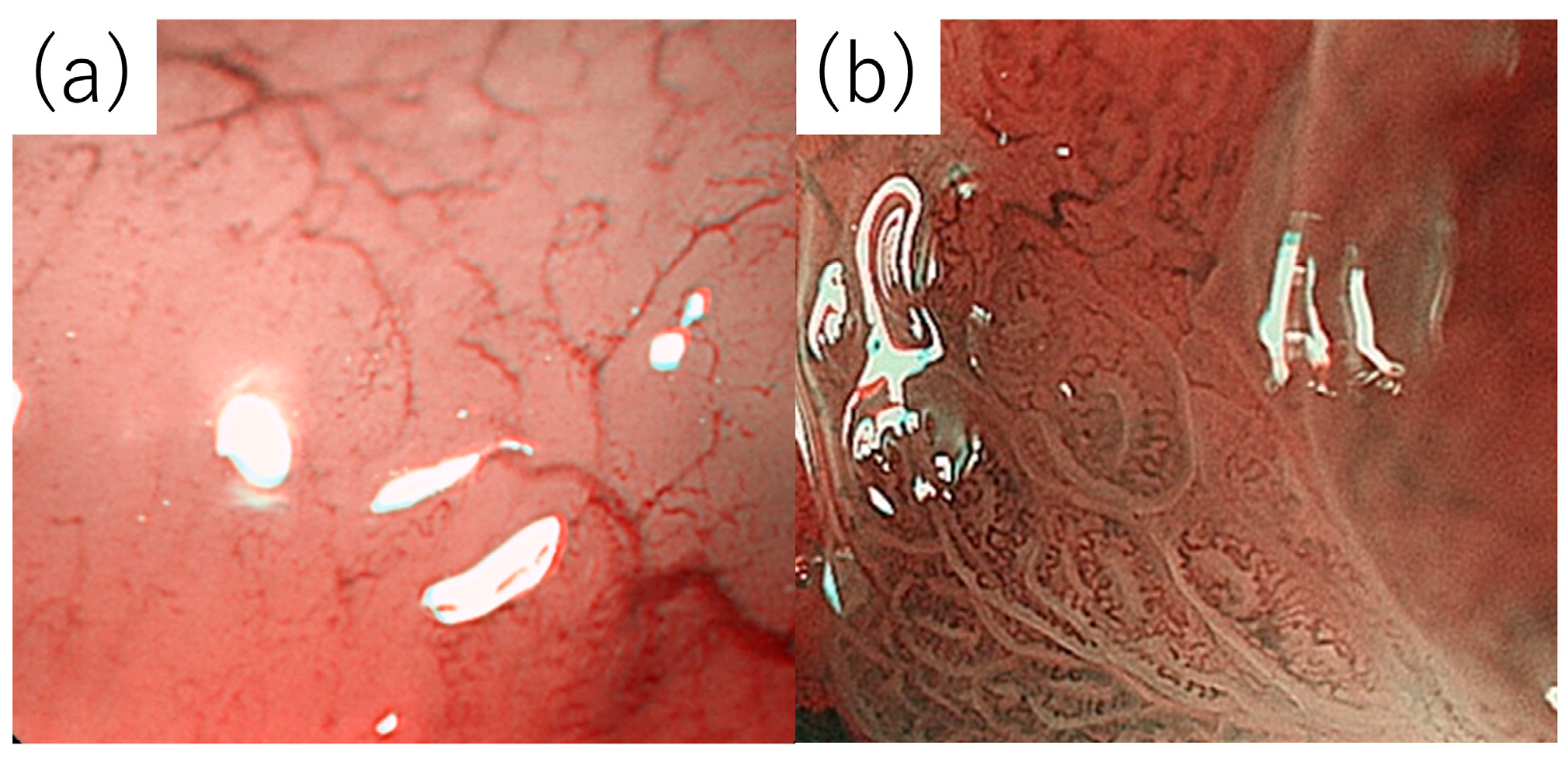 Diagnostics 14 00607 g001