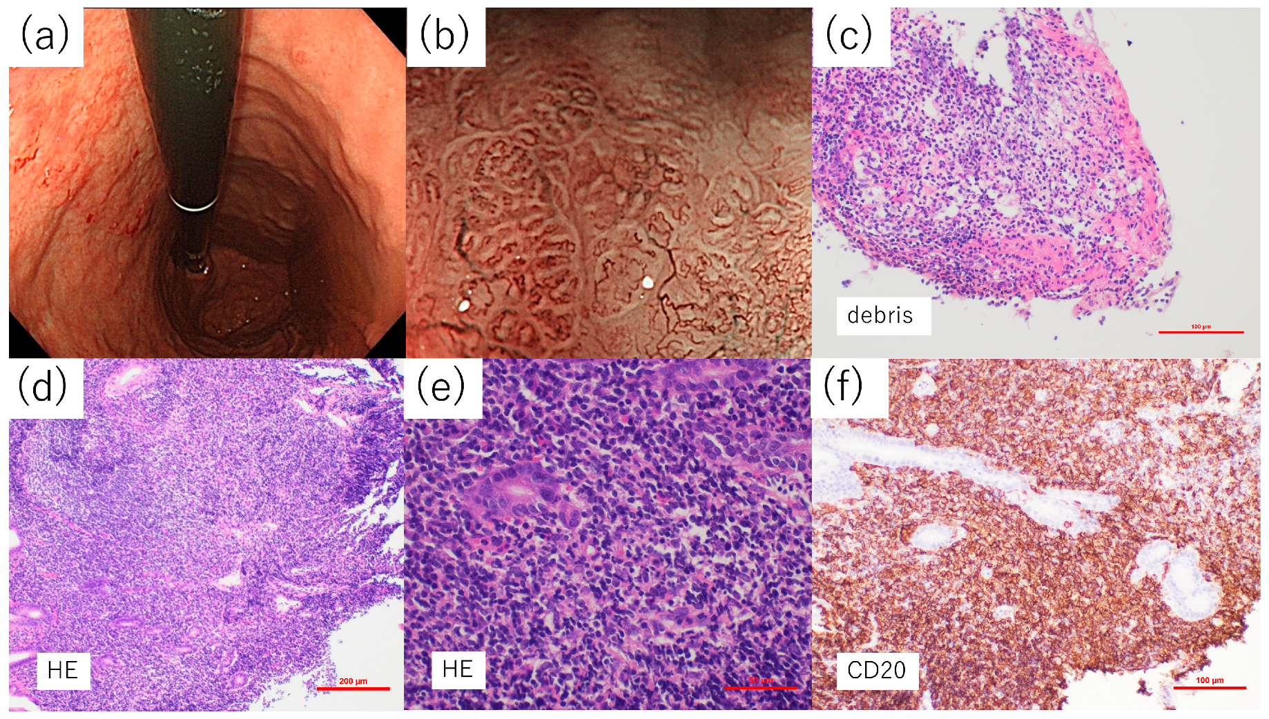 Diagnostics 14 00607 g004
