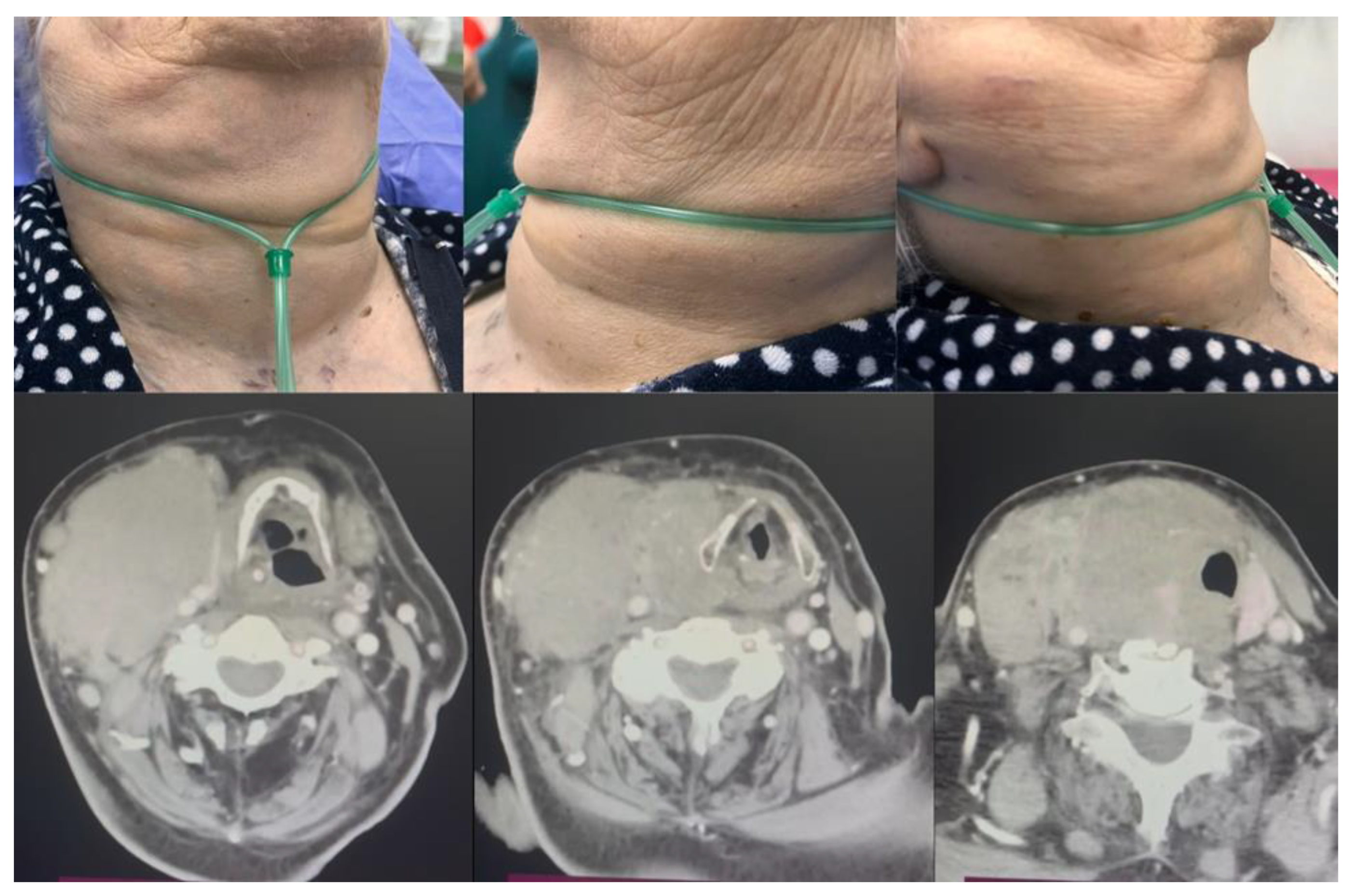 Diagnostics 14 00610 g006