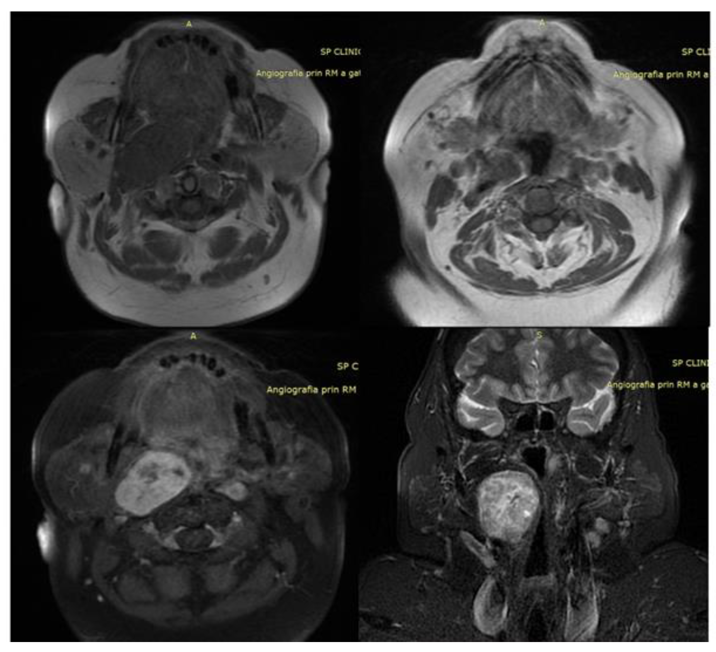 Diagnostics 14 00610 g007