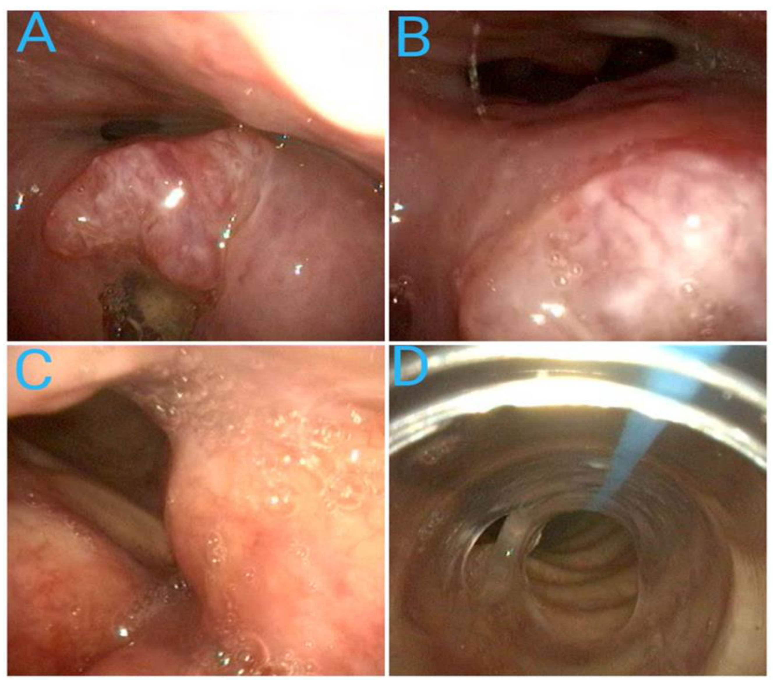 Diagnostics 14 00610 g008