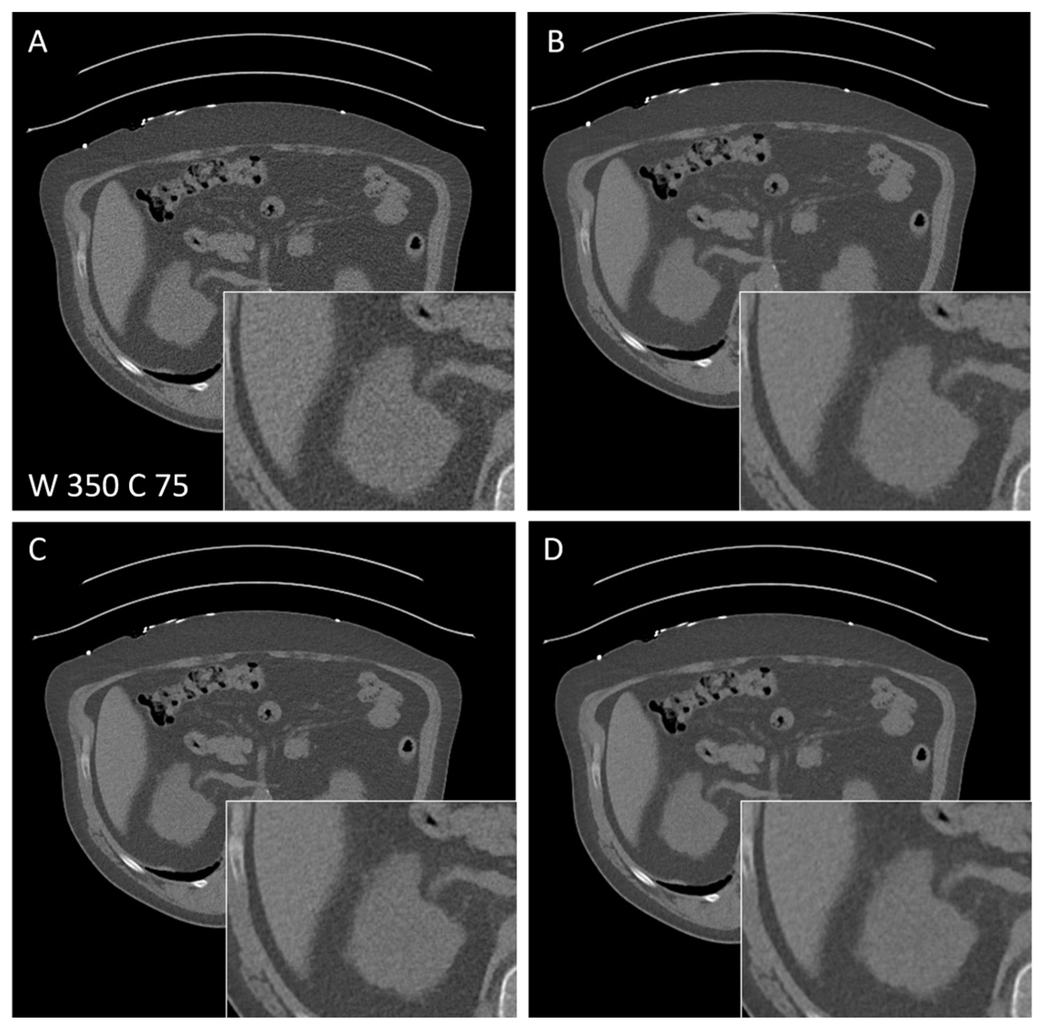 Diagnostics 14 00612 g004