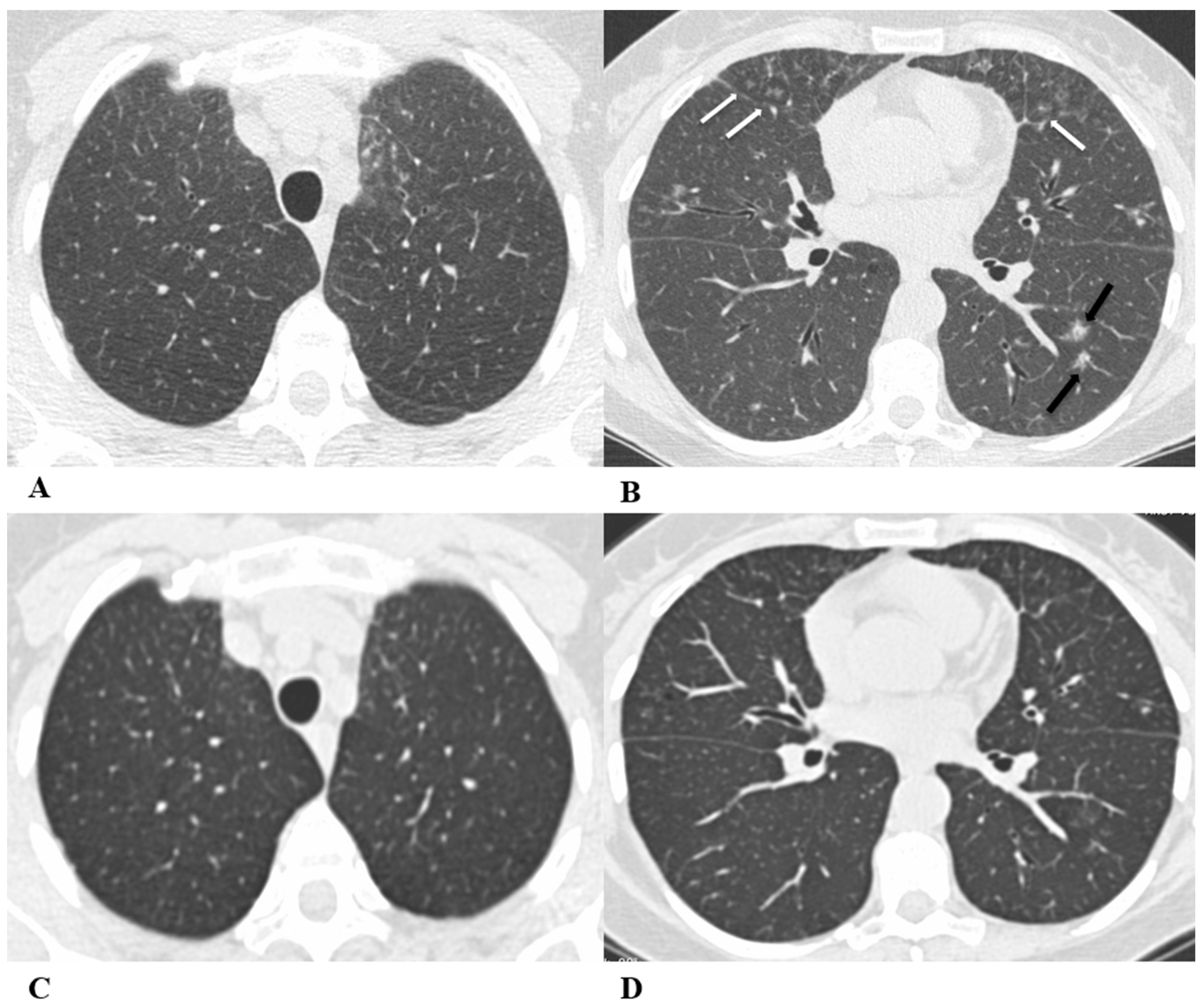 Diagnostics 14 00613 g005