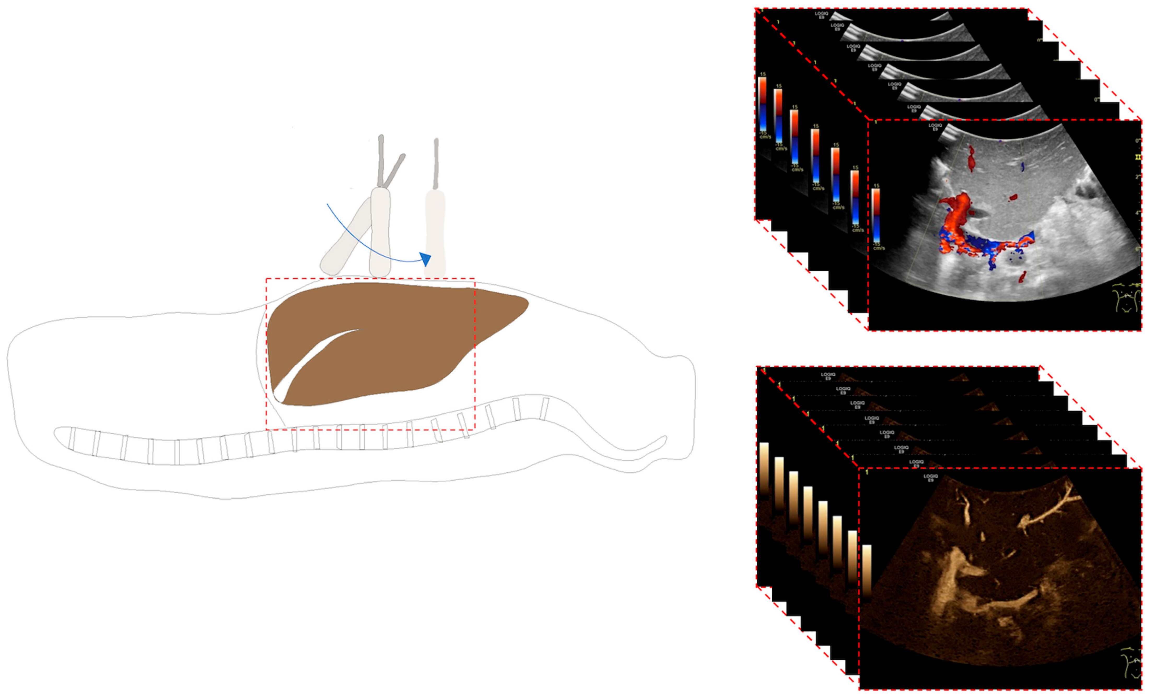 Diagnostics 14 00617 g001