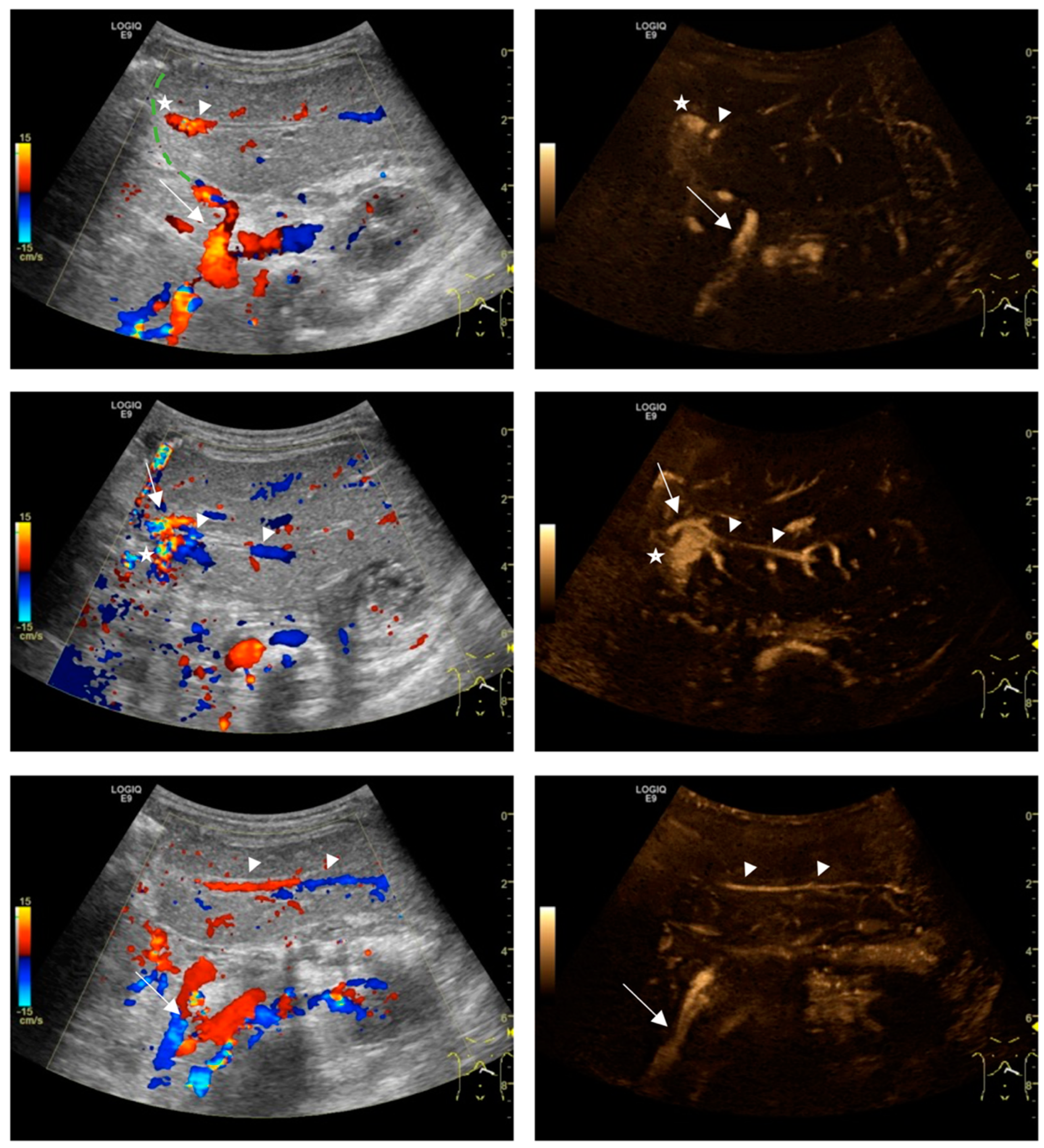 Diagnostics 14 00617 g004