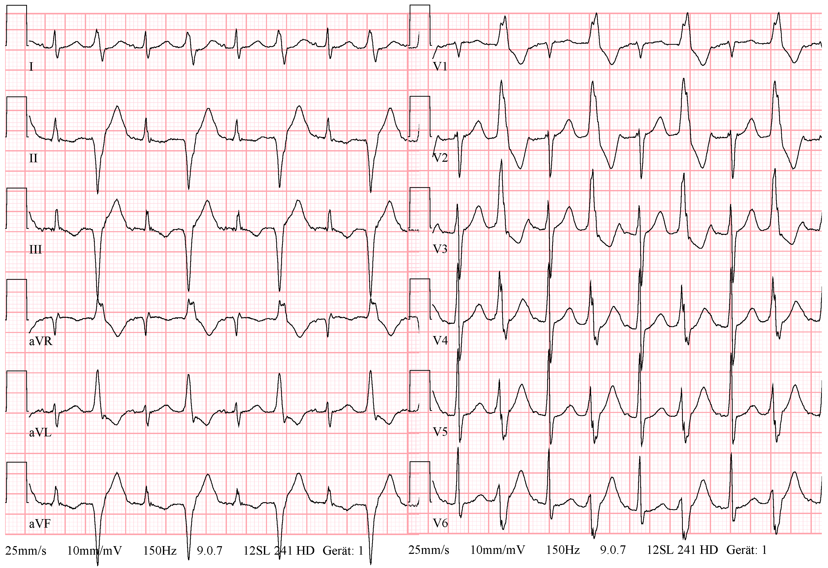 Diagnostics 14 00622 g001