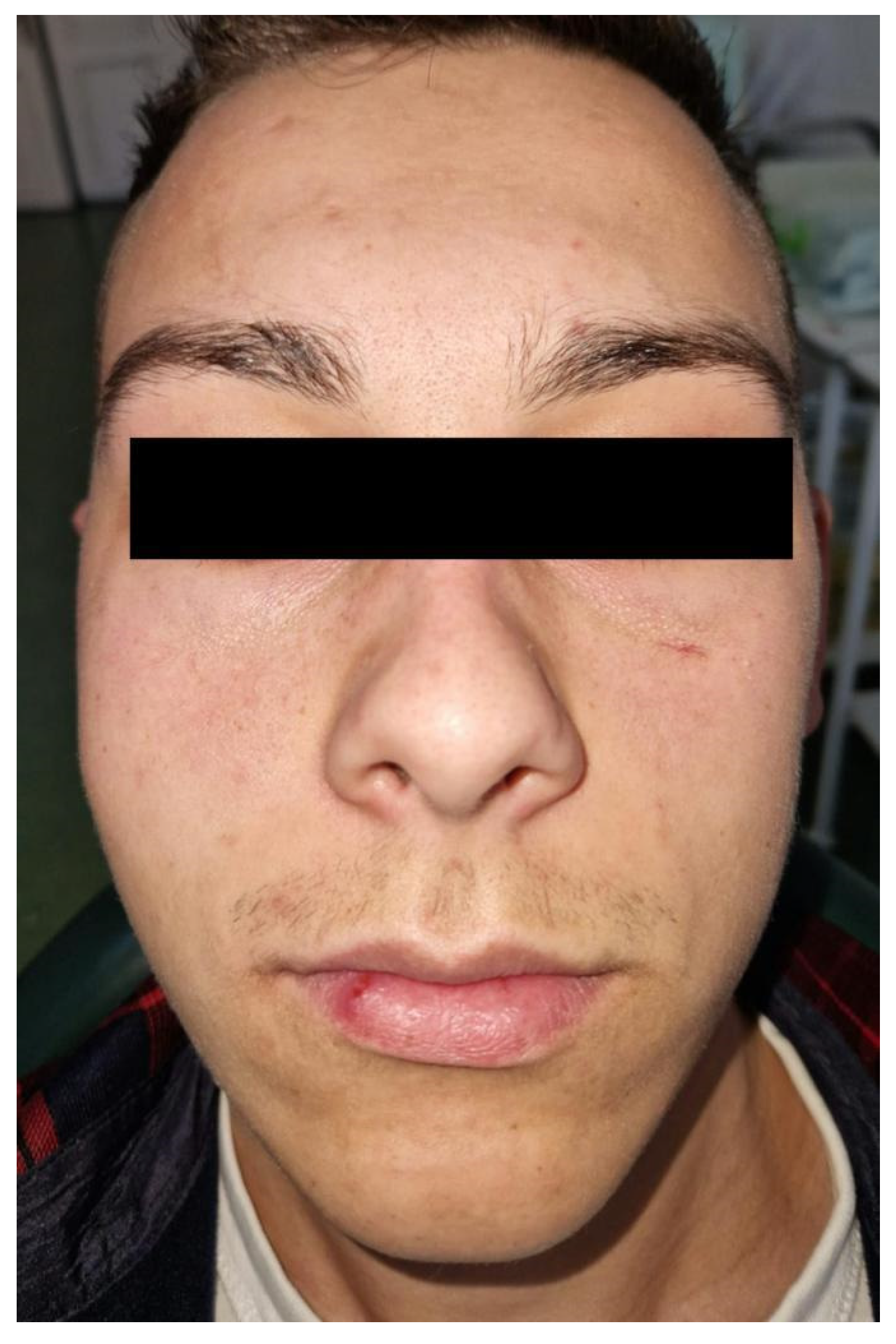 Diagnostics 14 00628 g001