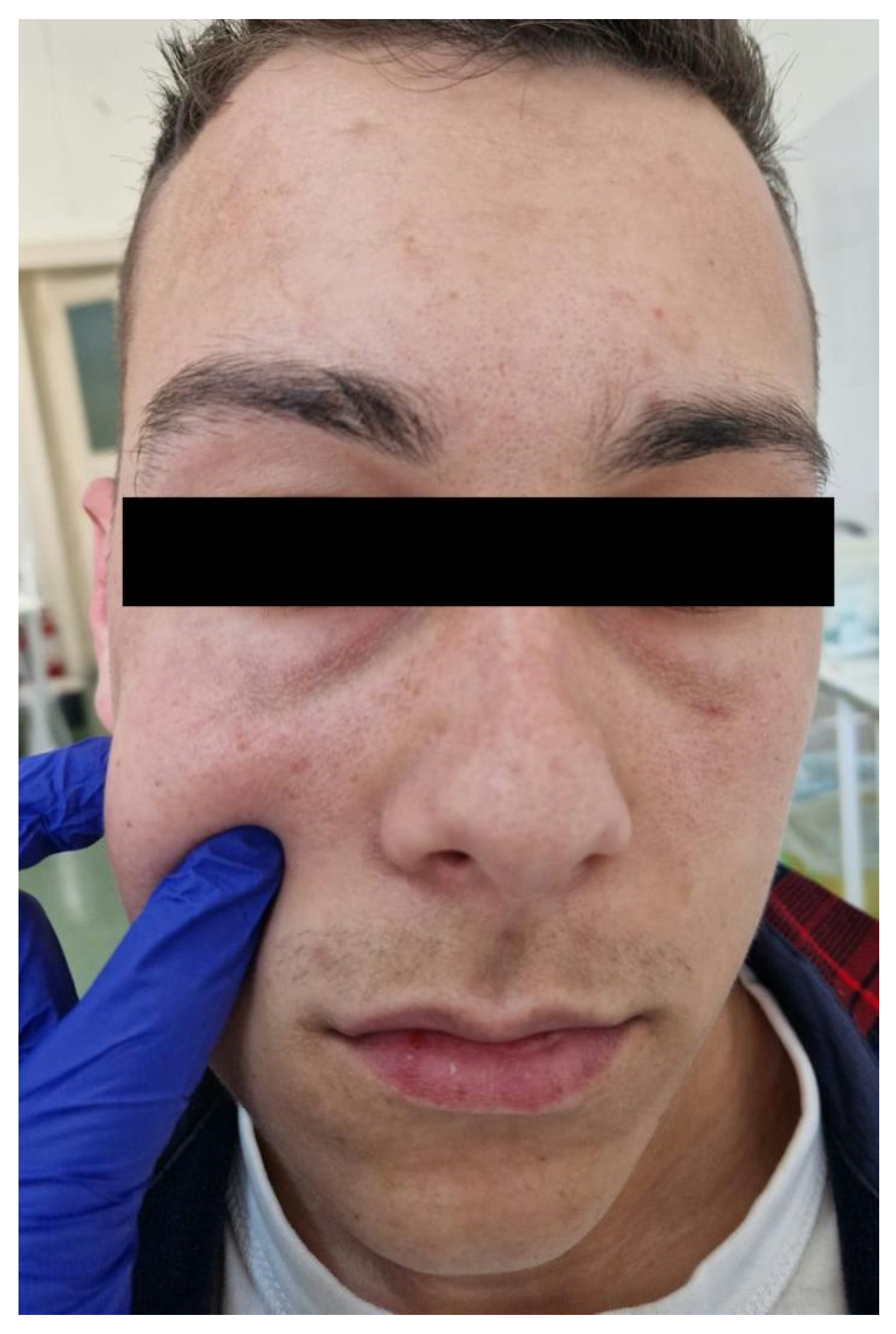 Diagnostics 14 00628 g002