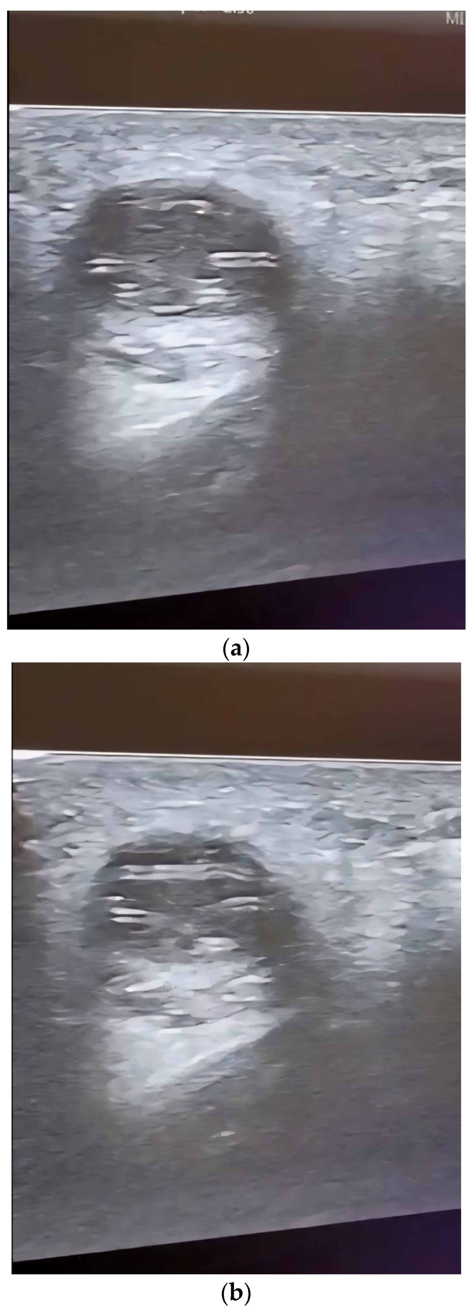 Diagnostics 14 00628 g003