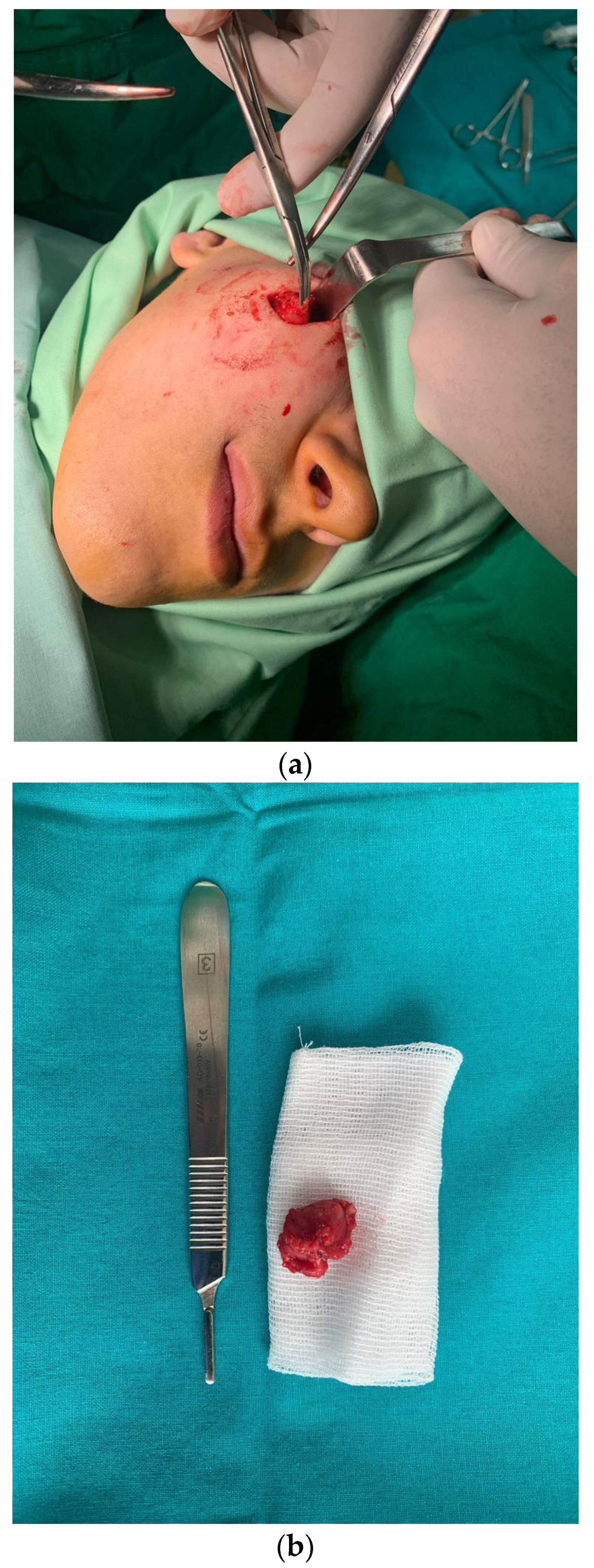 Diagnostics 14 00628 g004