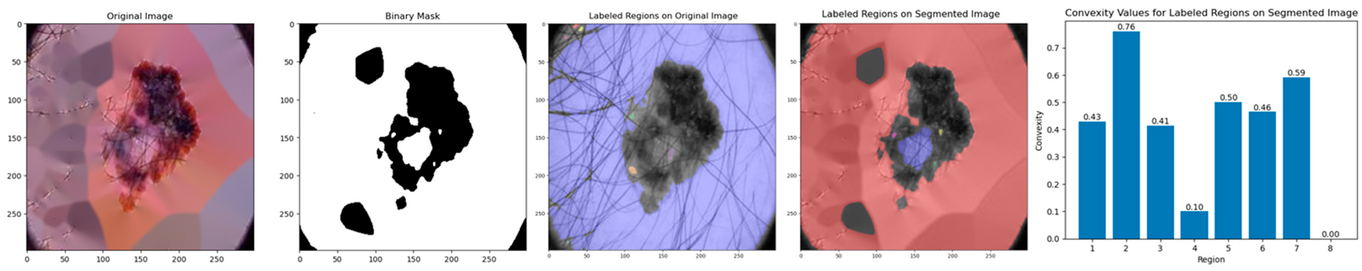 Diagnostics 14 00636 g011