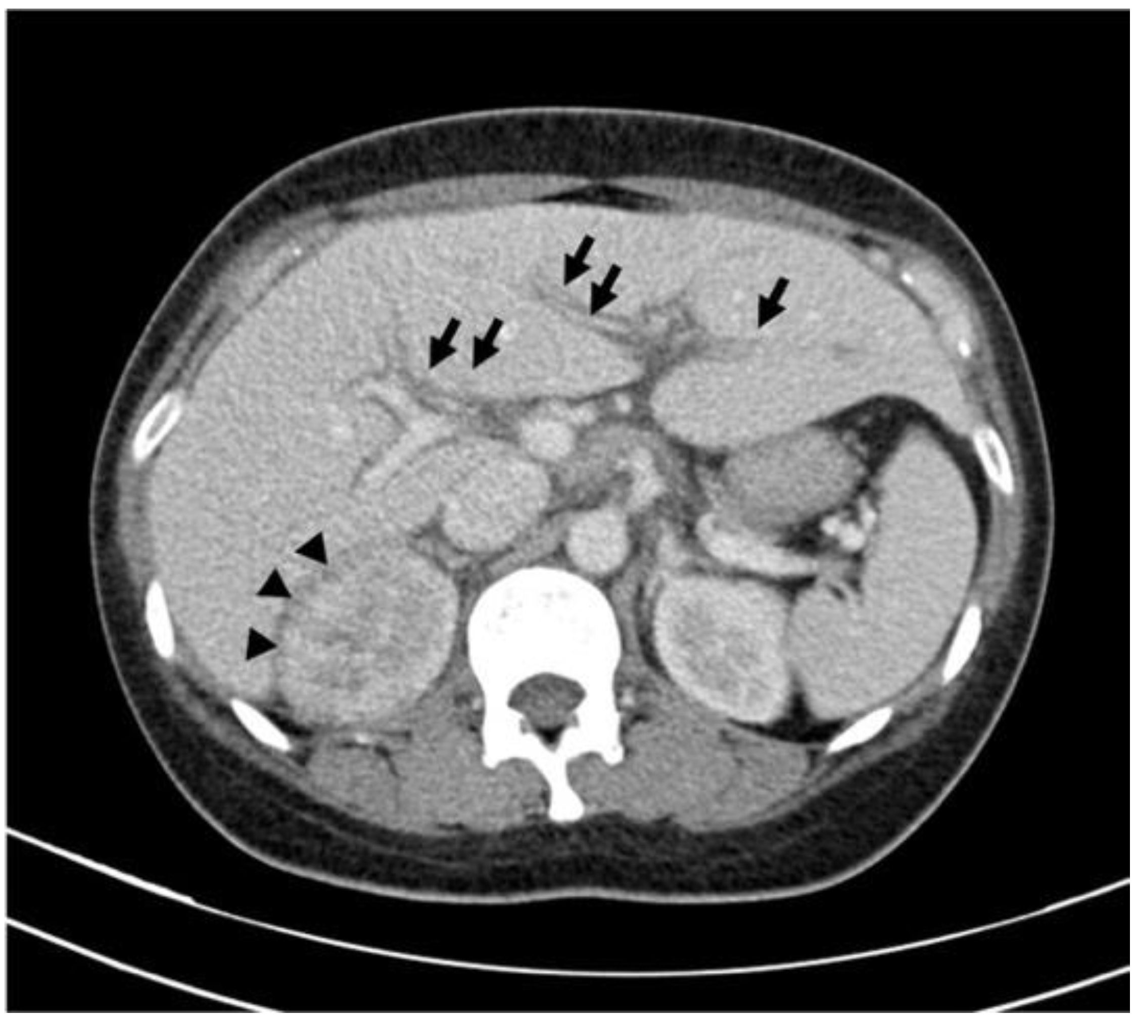 Diagnostics 14 00638 g001