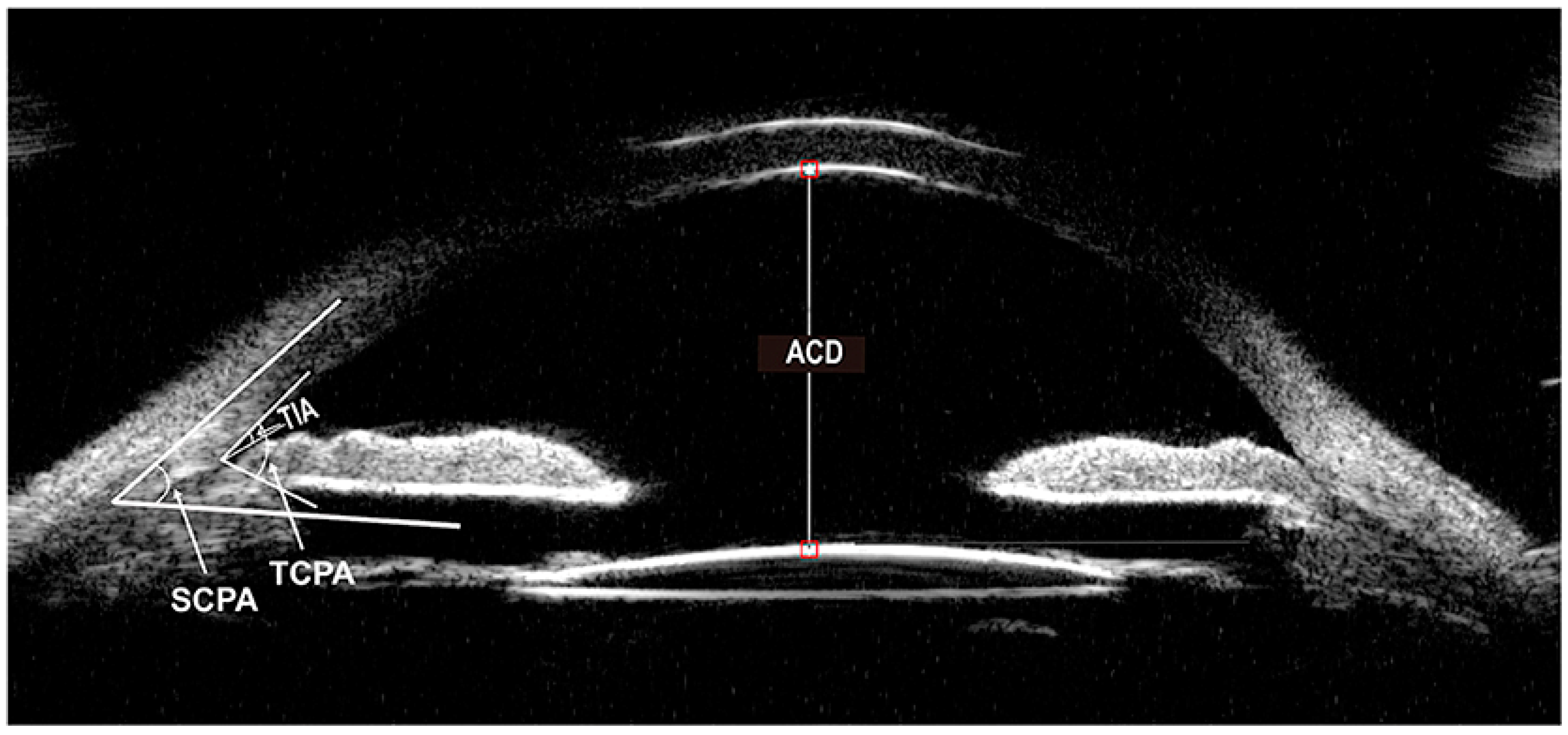 Diagnostics 14 00639 g001