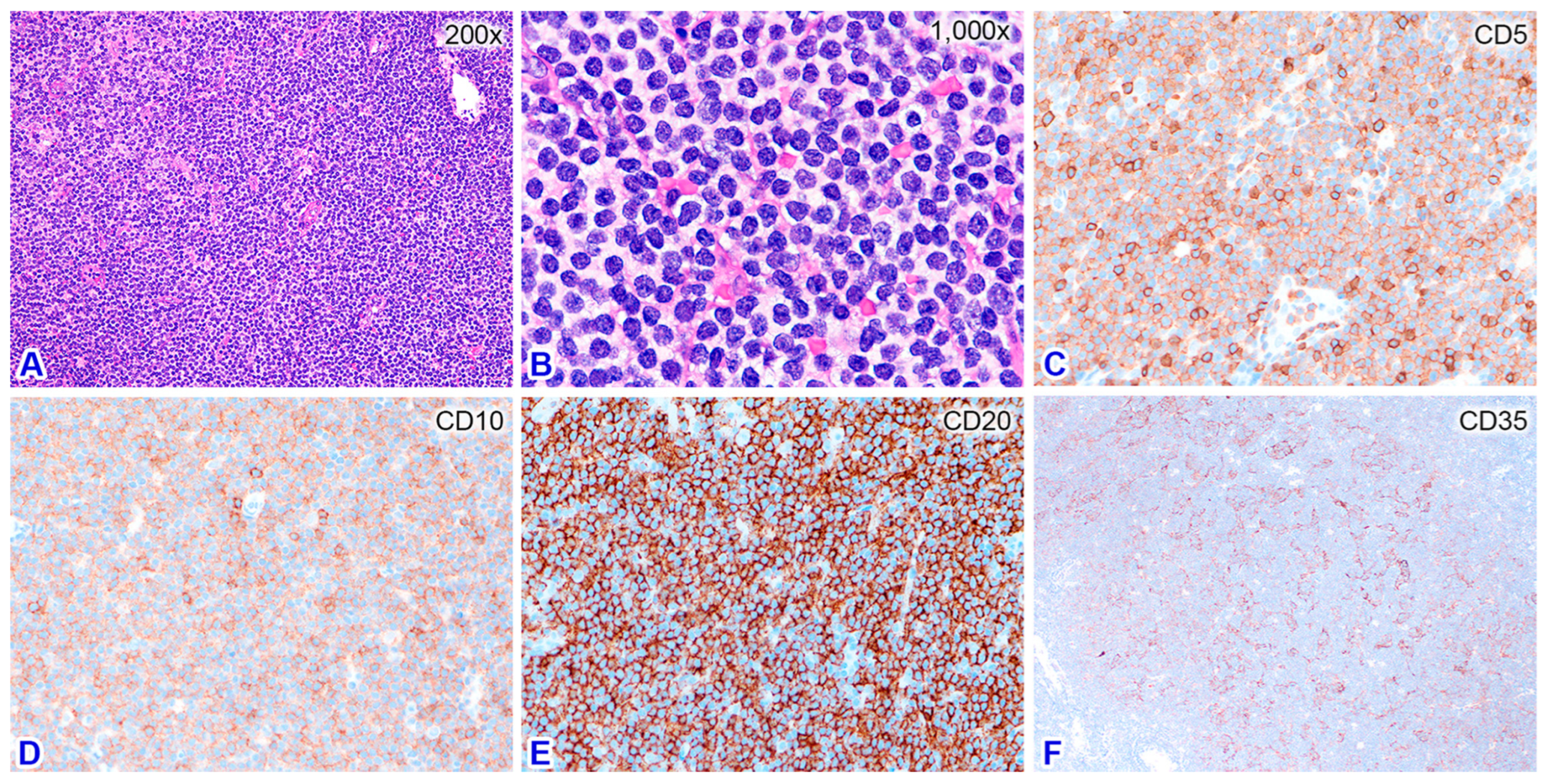 Diagnostics 14 00640 g002