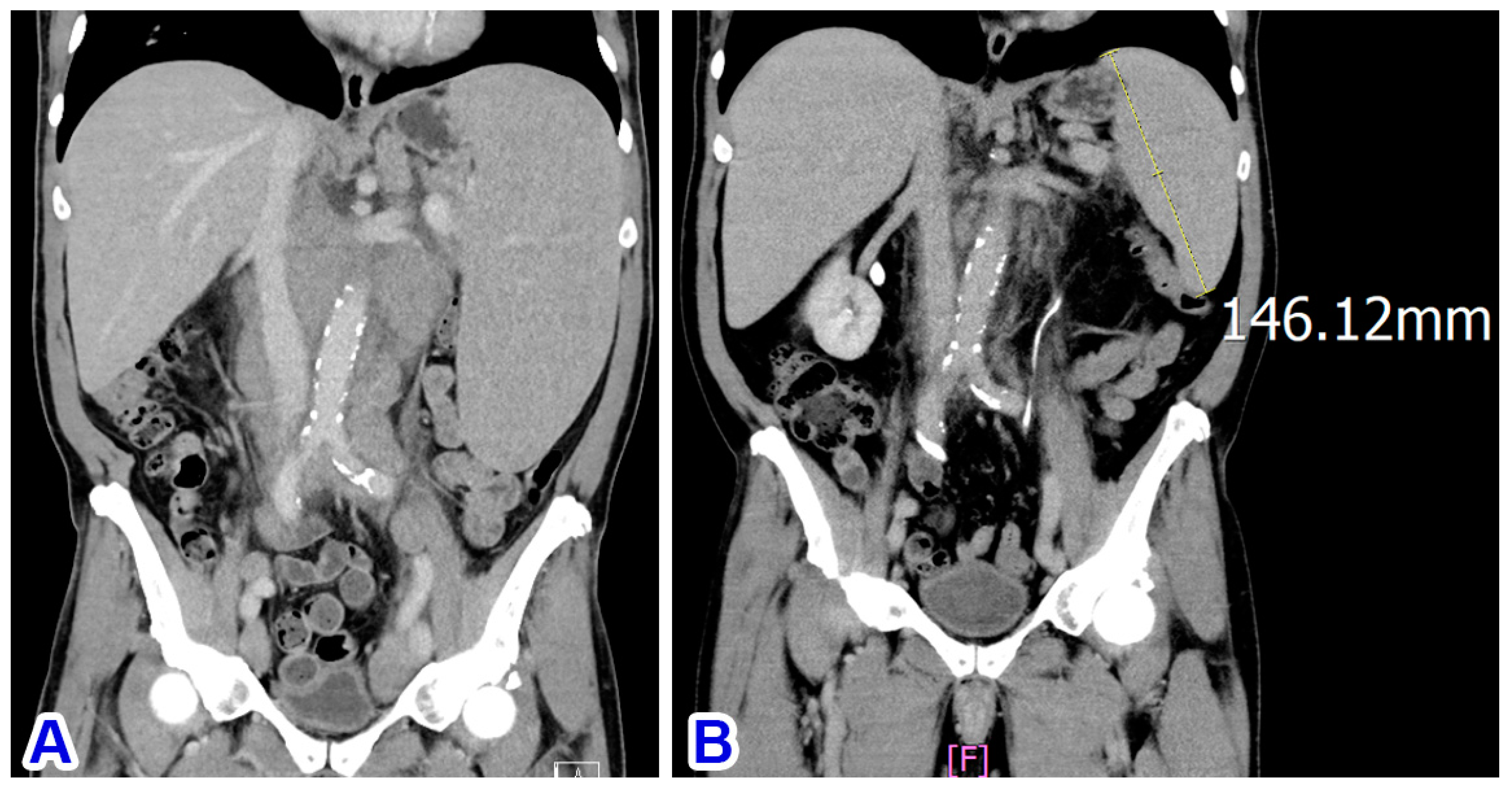 Diagnostics 14 00640 g003