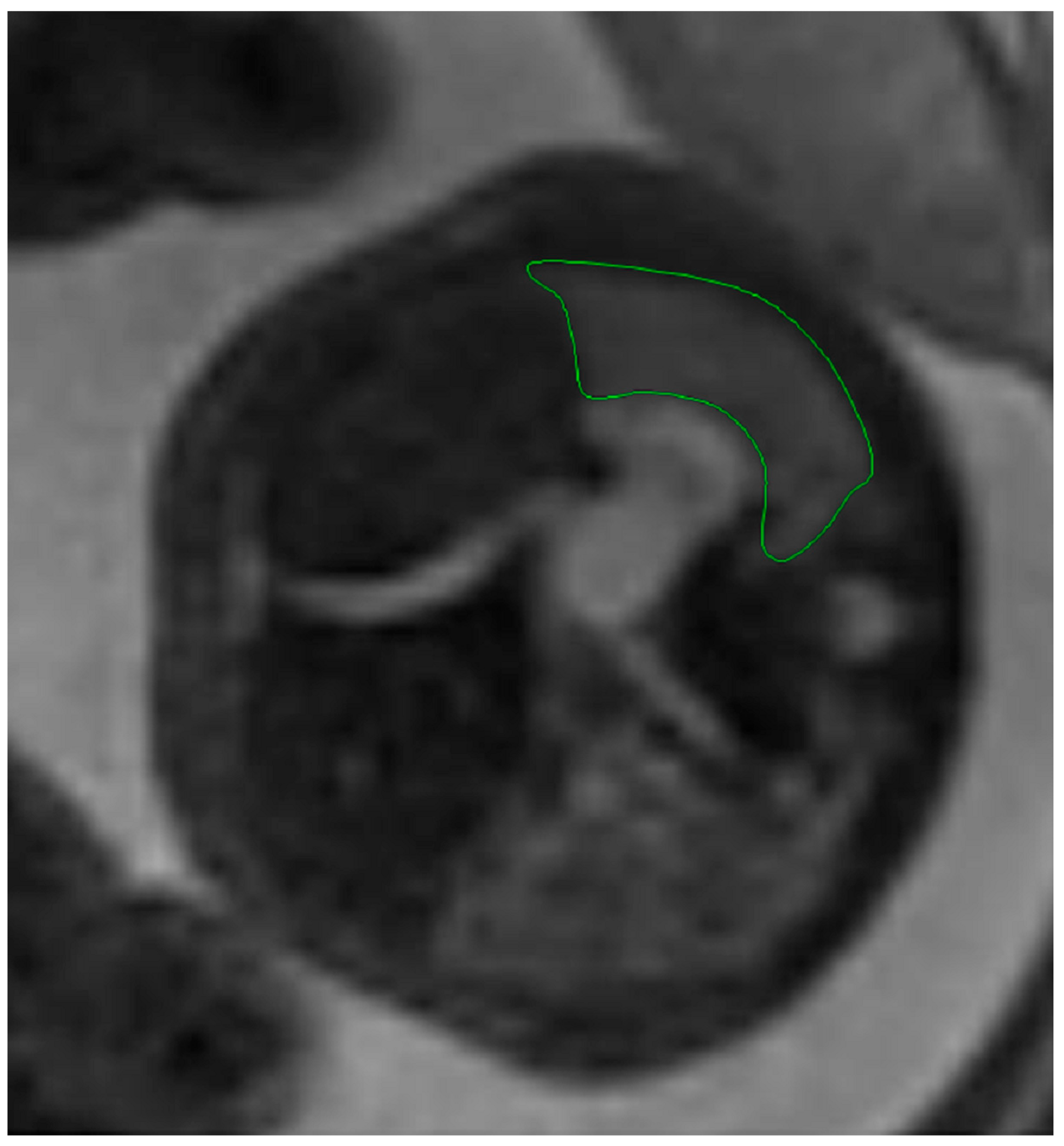 Diagnostics 14 00641 g001