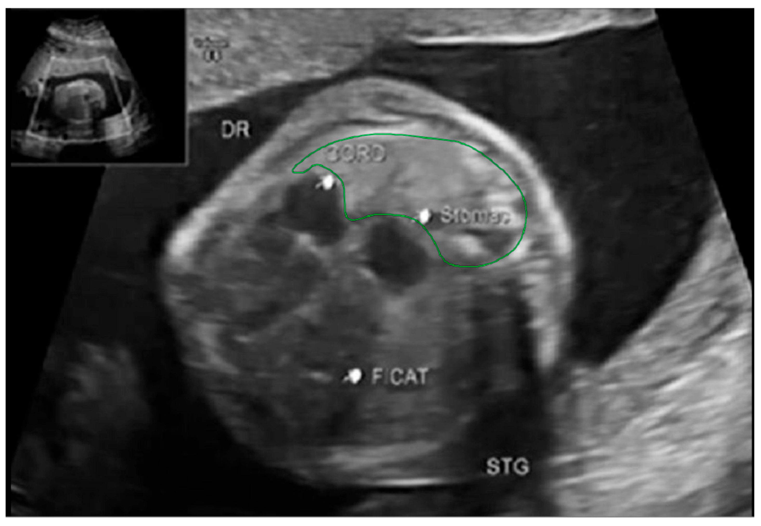 Diagnostics 14 00641 g002