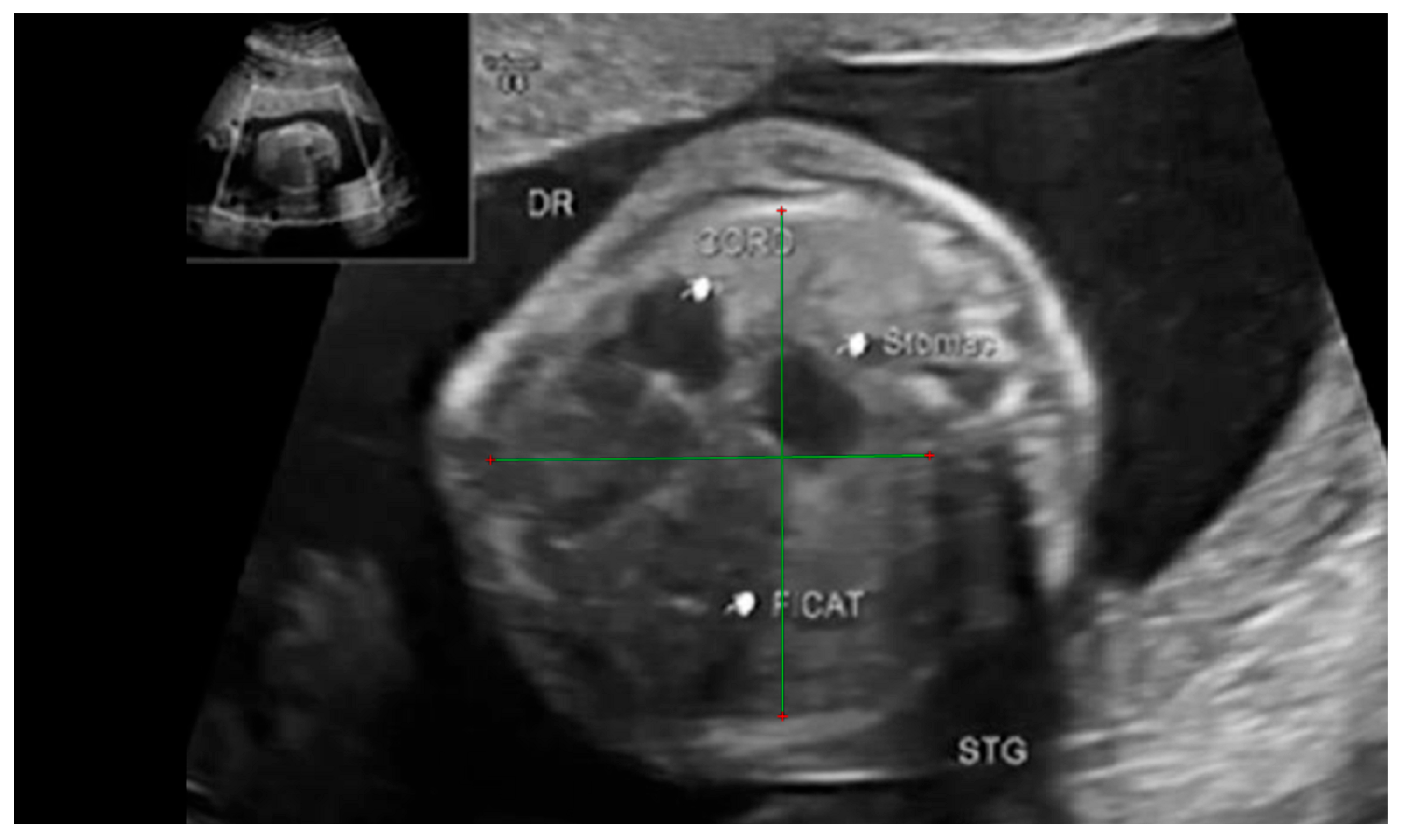 Diagnostics 14 00641 g004