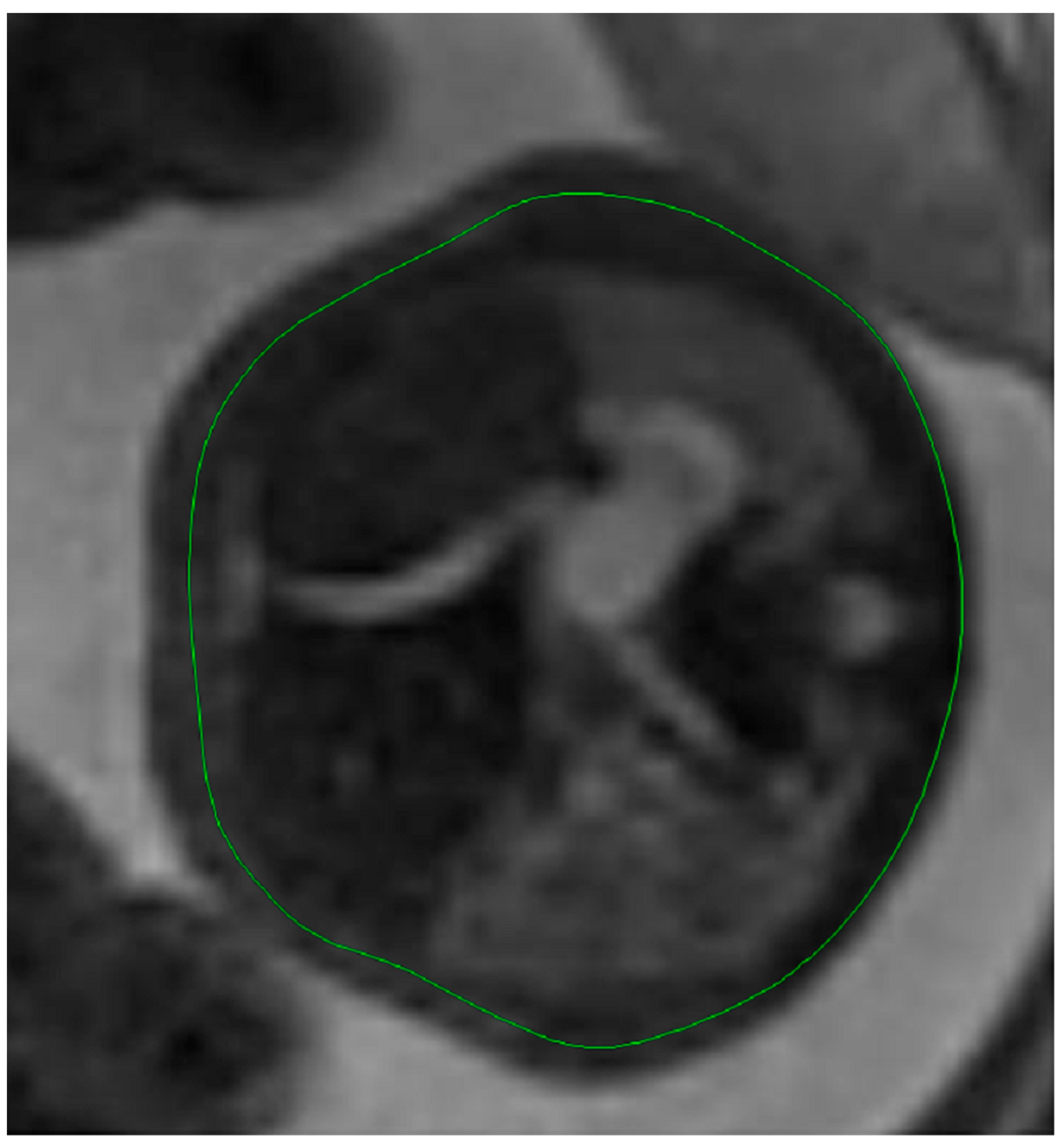 Diagnostics 14 00641 g005