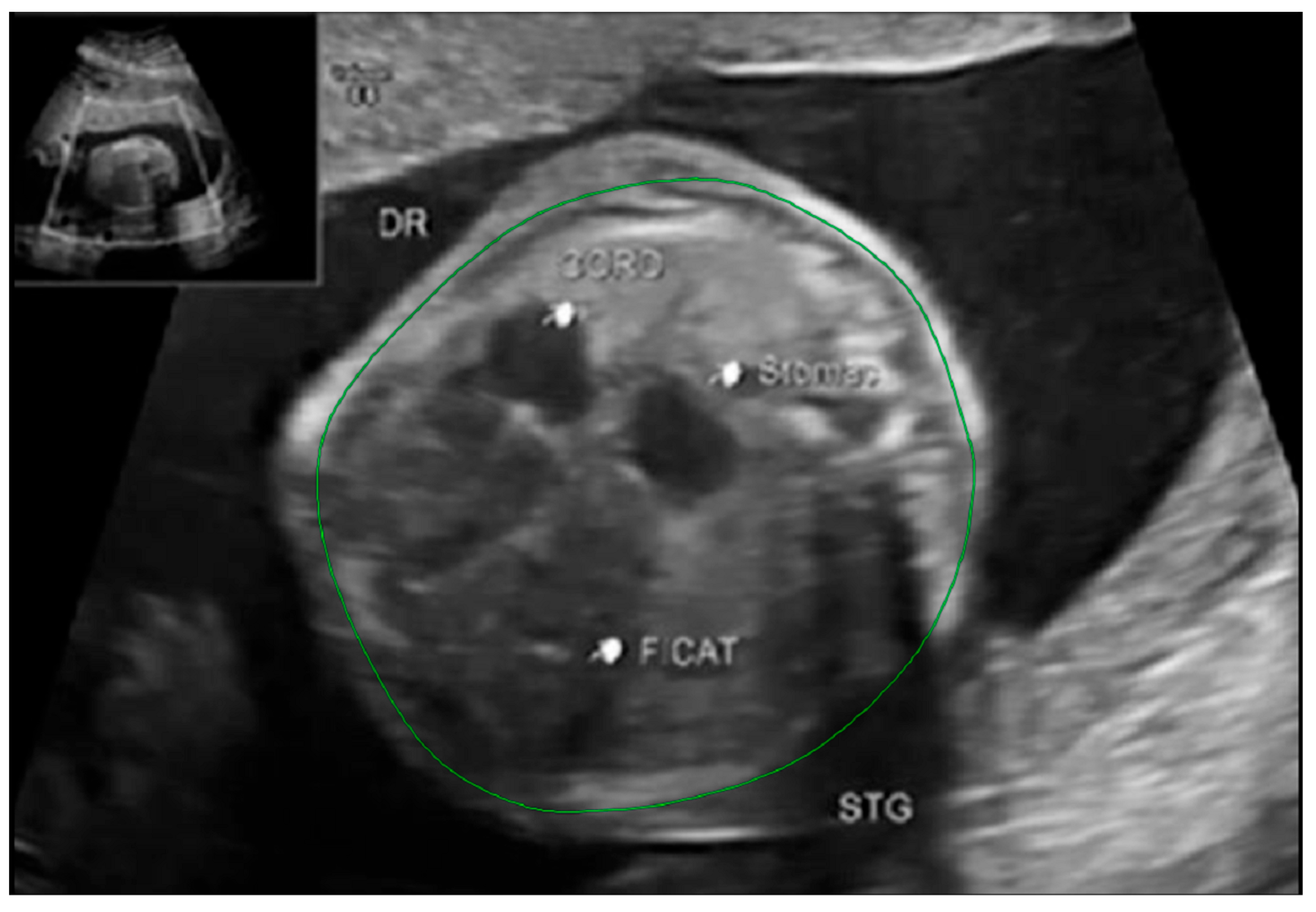 Diagnostics 14 00641 g006