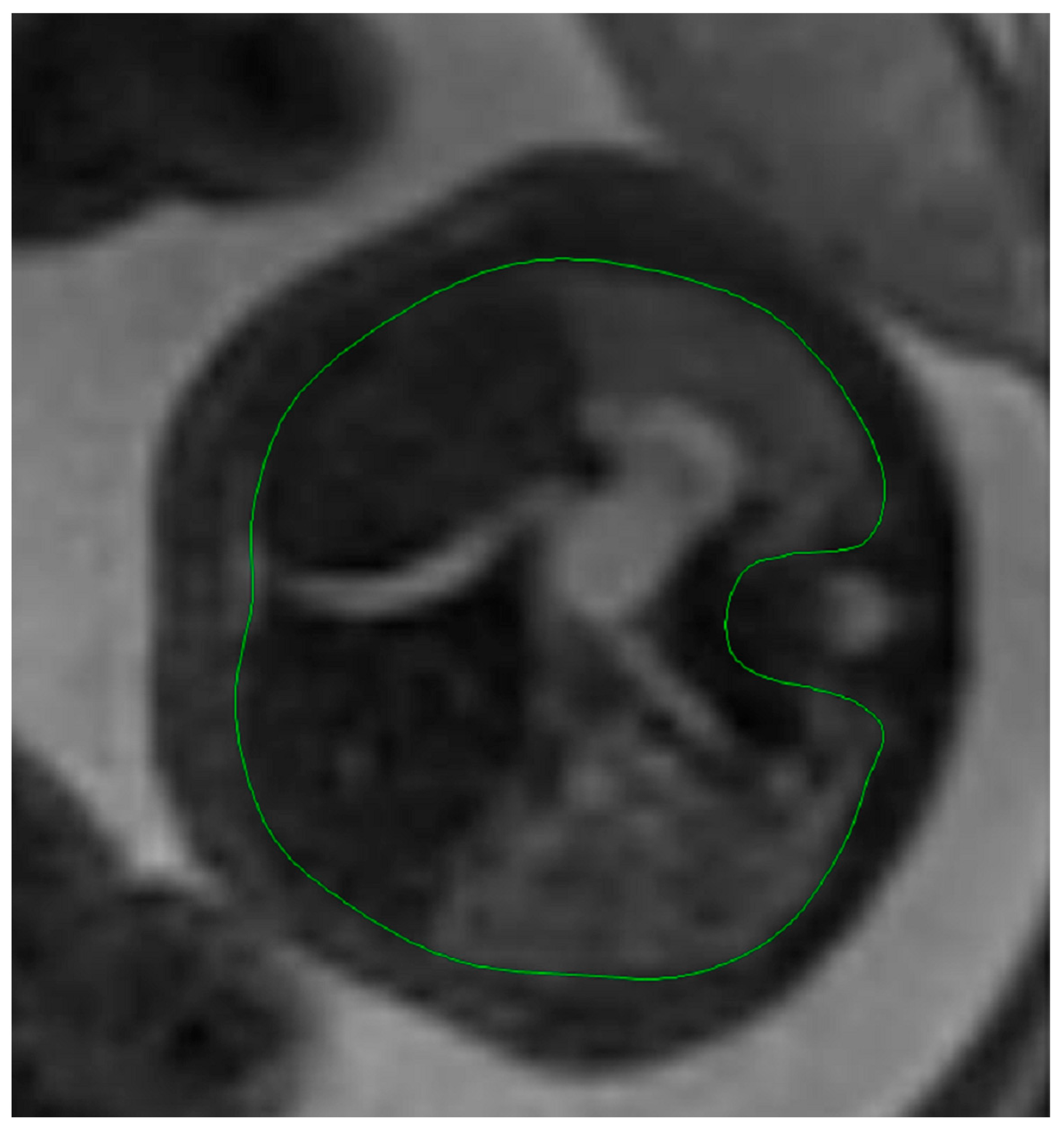 Diagnostics 14 00641 g007