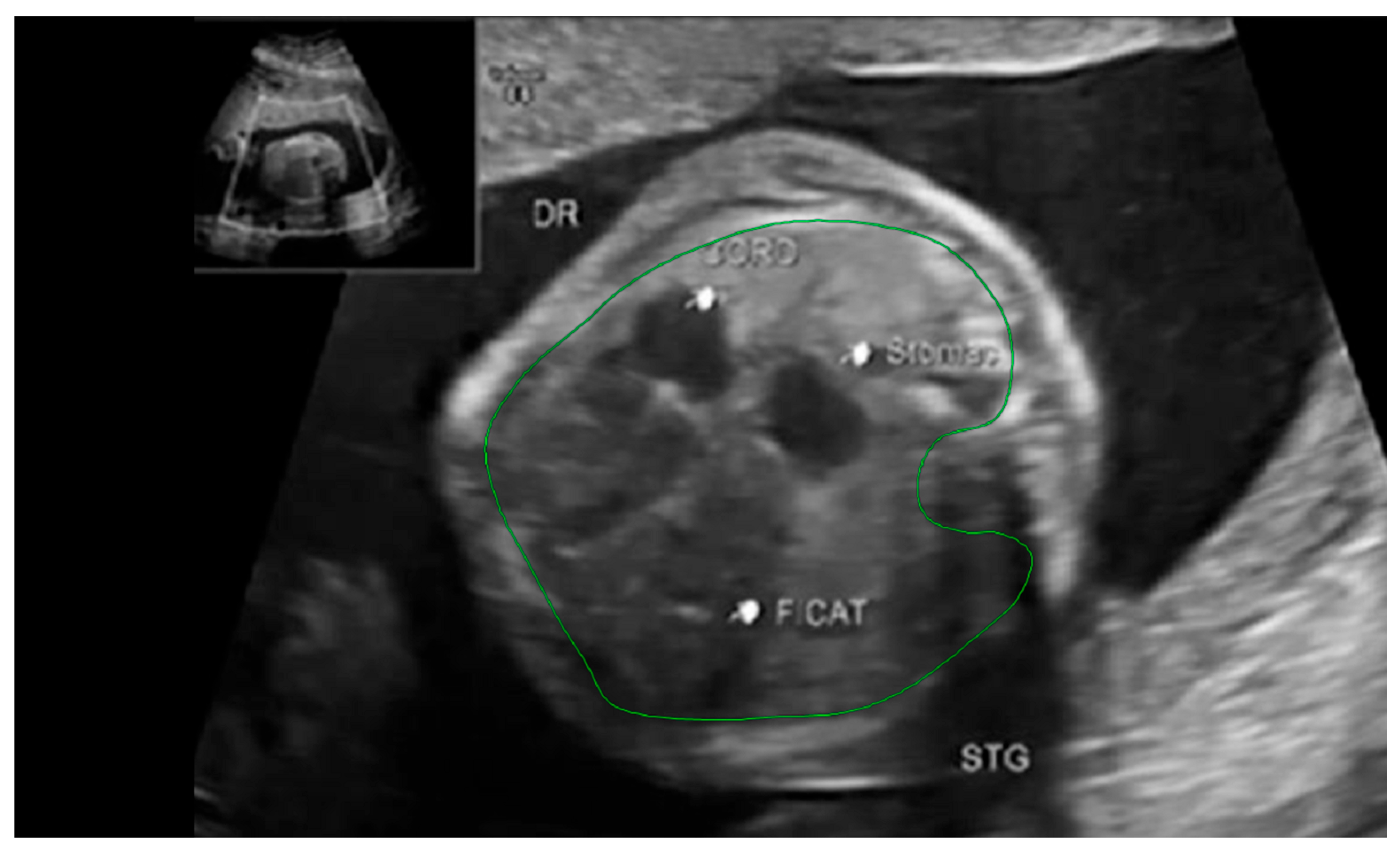 Diagnostics 14 00641 g008