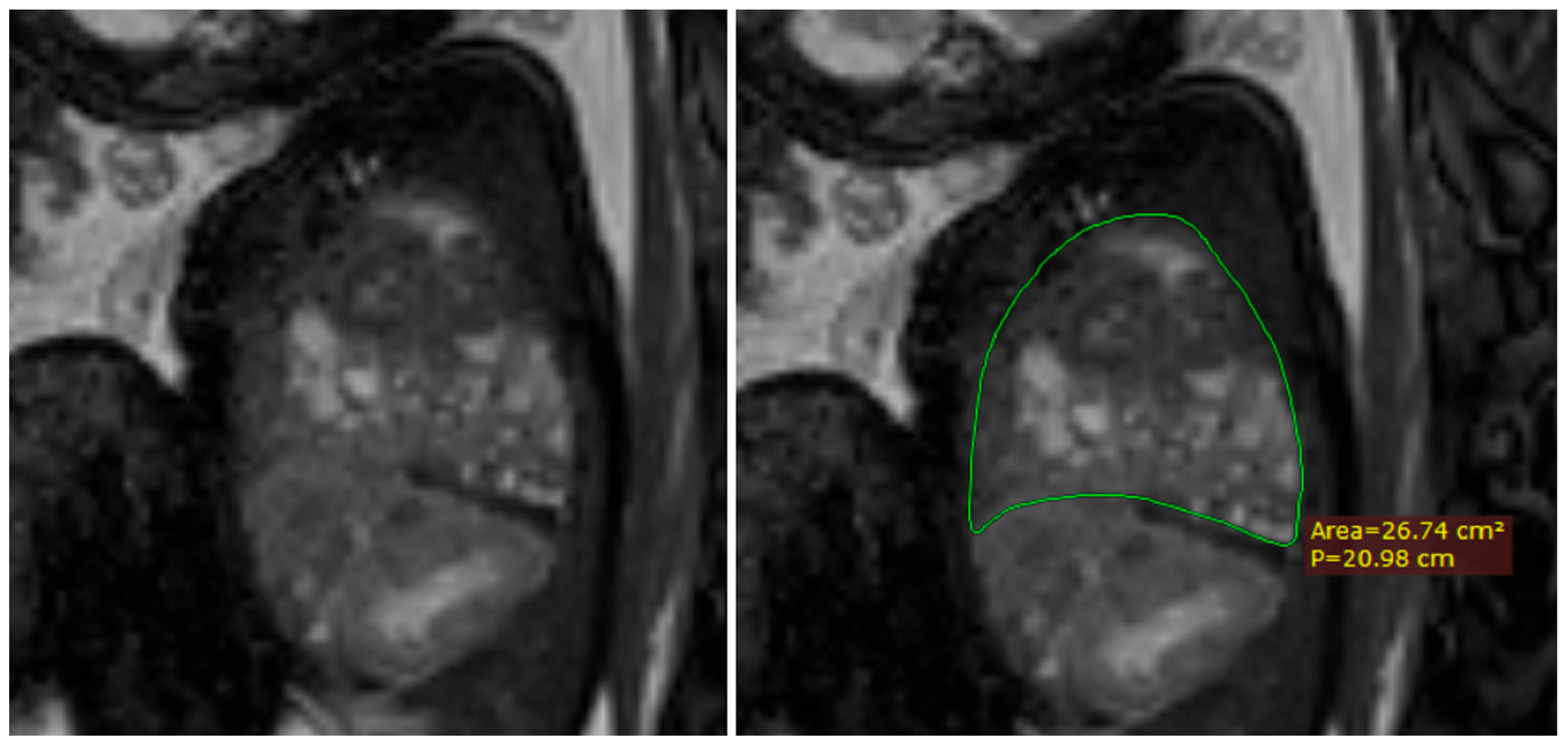 Diagnostics 14 00641 g009