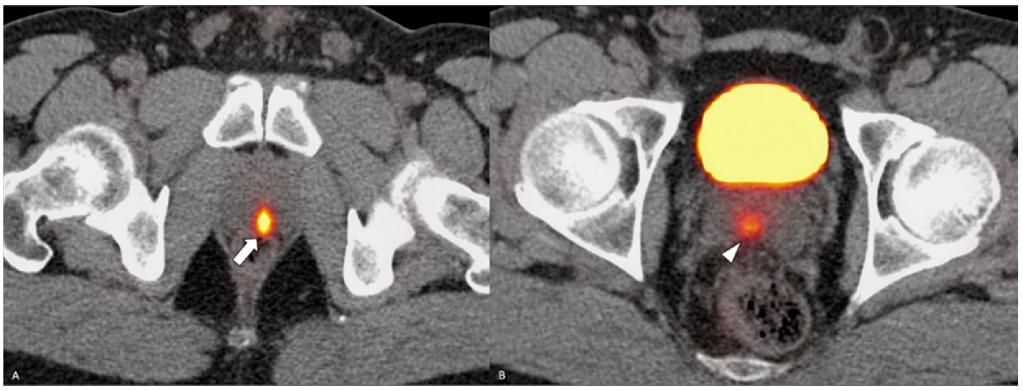Diagnostics 14 00645 g002 Diagnostics 14 00645 g002
