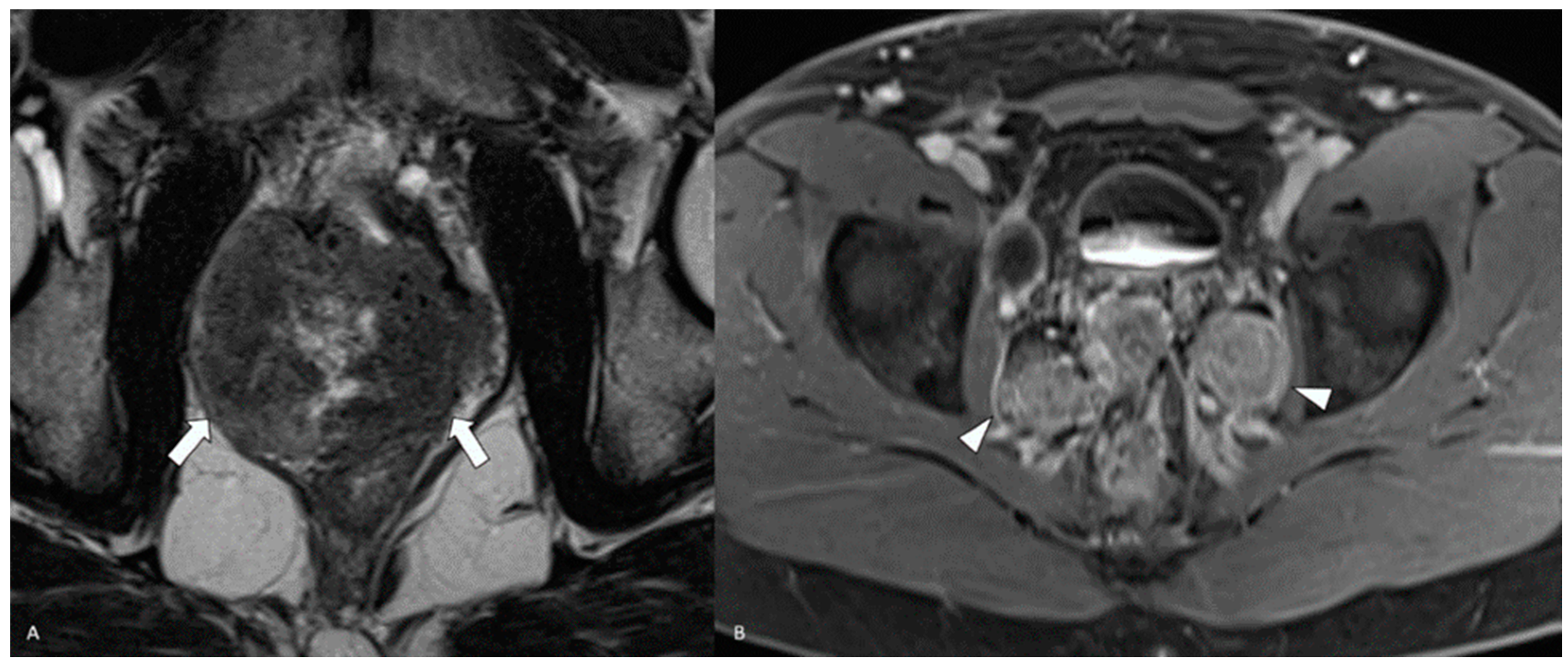 Diagnostics 14 00645 g006 Diagnostics 14 00645 g006