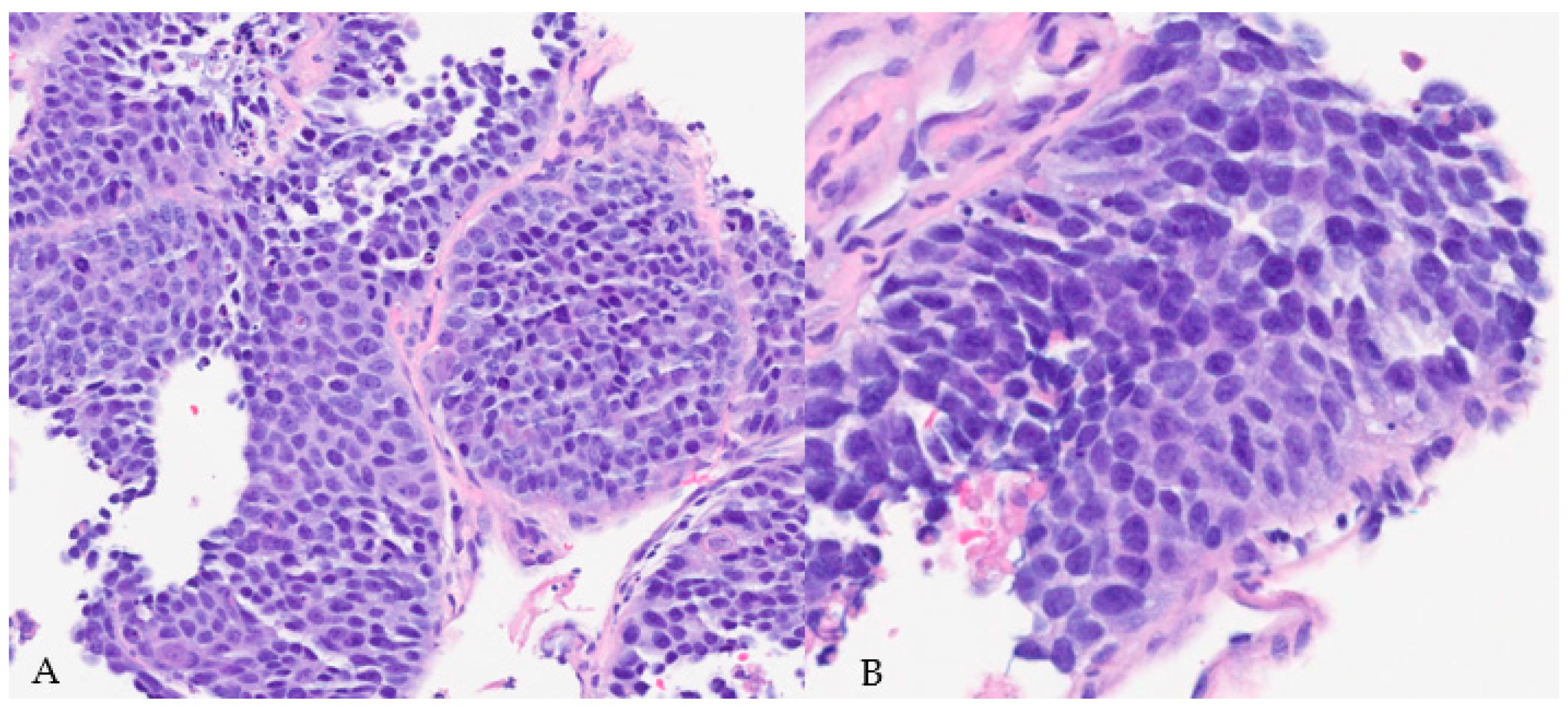 Diagnostics 14 00645 g008 Diagnostics 14 00645 g008