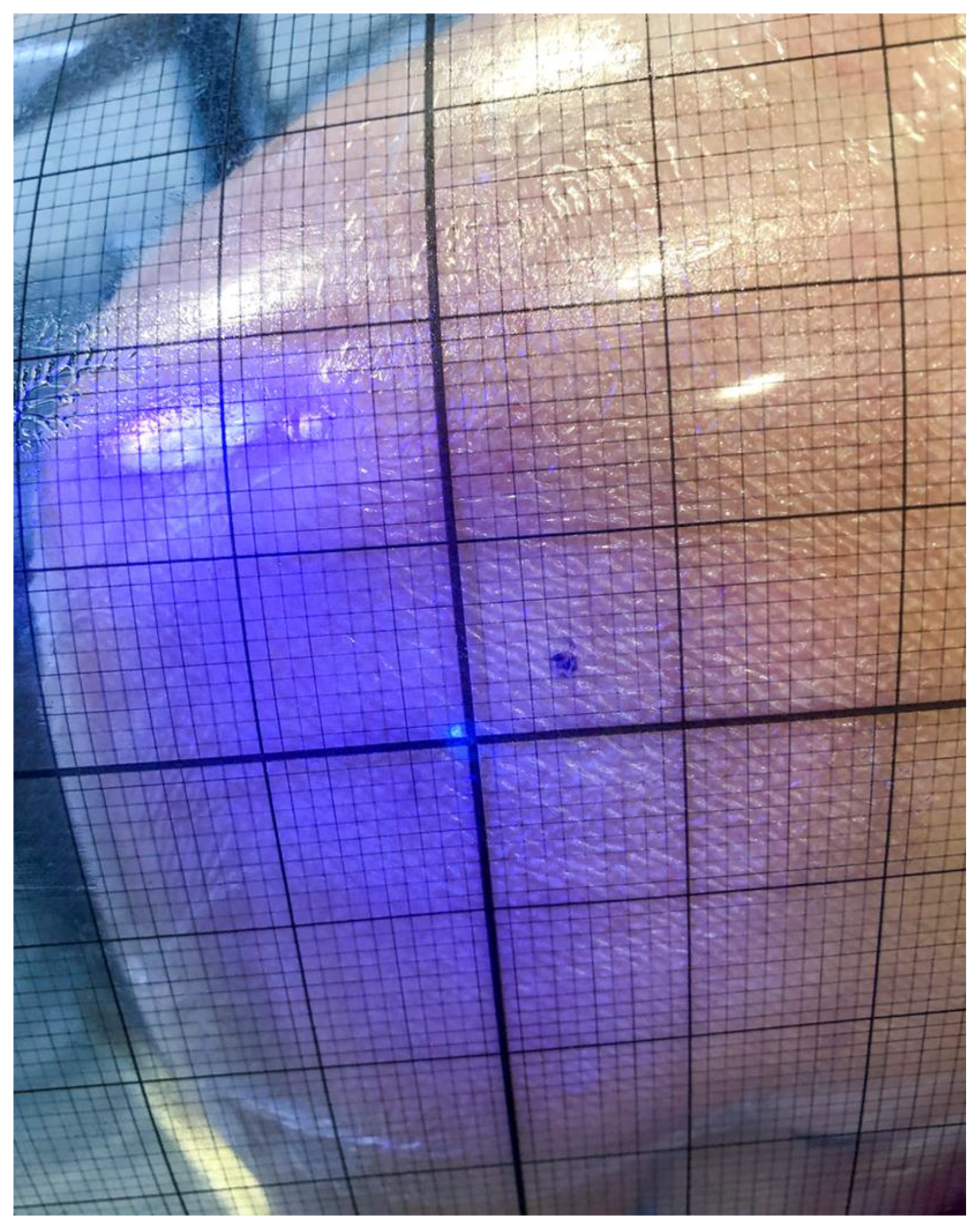 Diagnostics 14 00650 g001