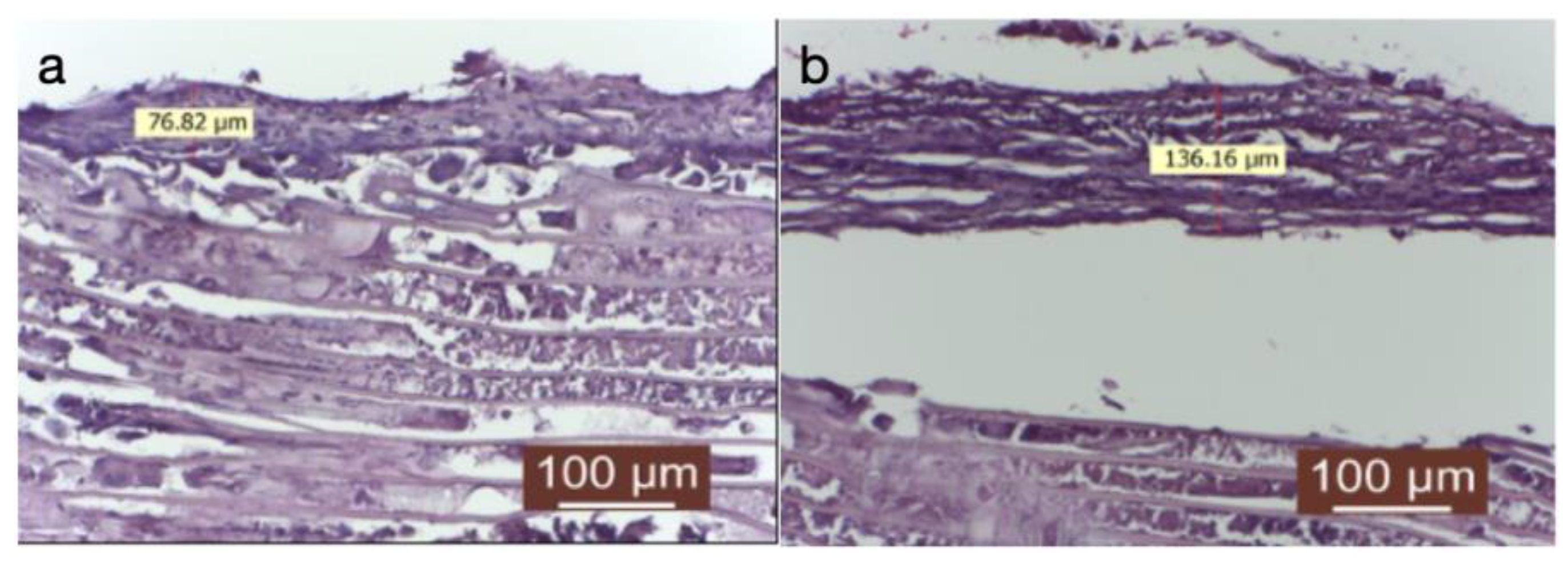 Diagnostics 14 00661 g004