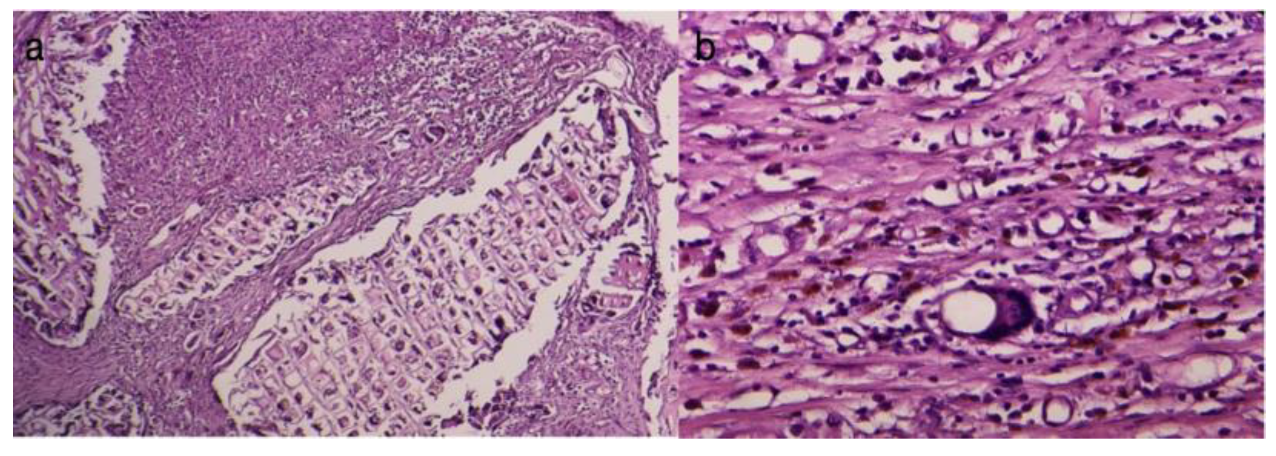 Diagnostics 14 00661 g009