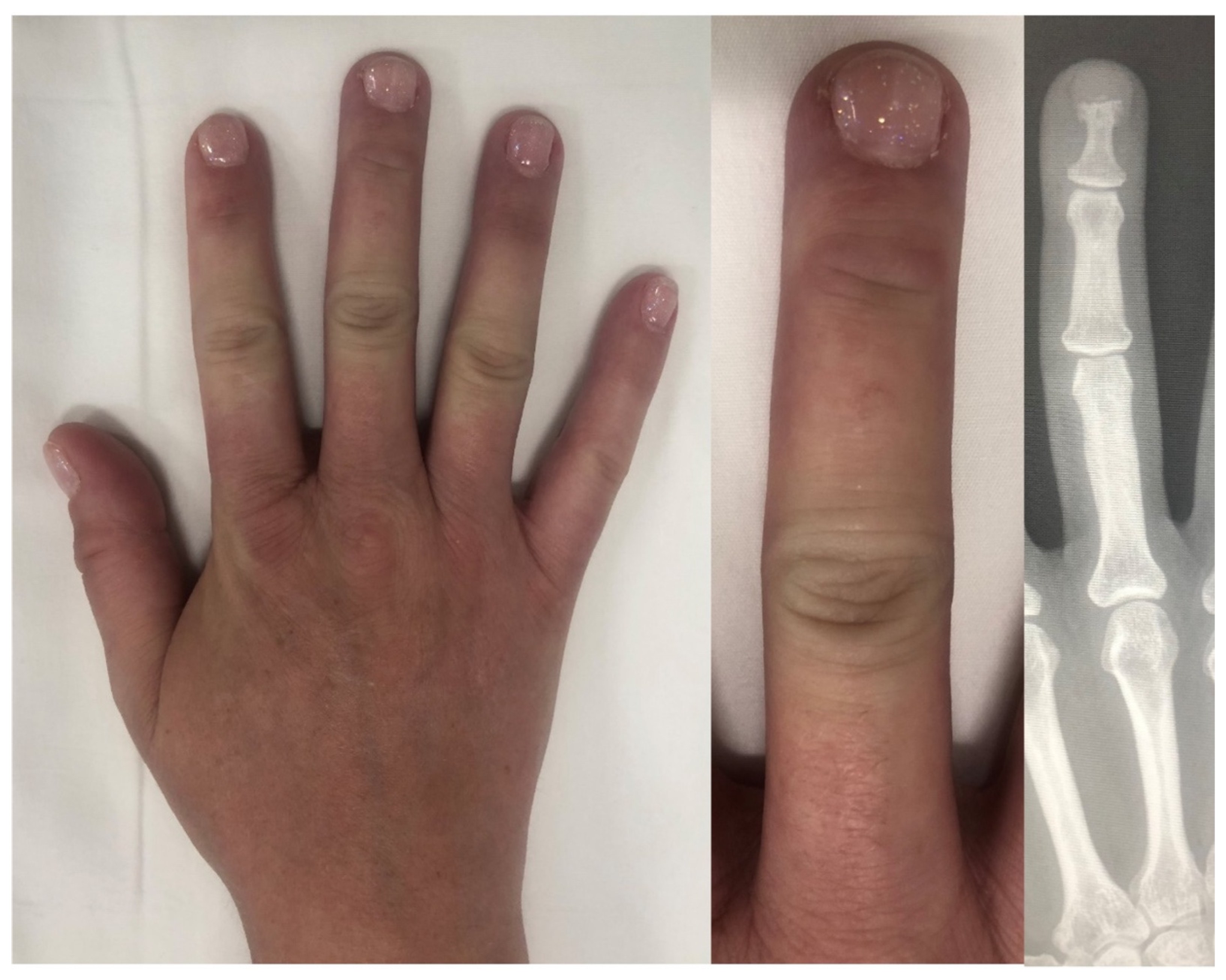 Diagnostics 14 00669 g011