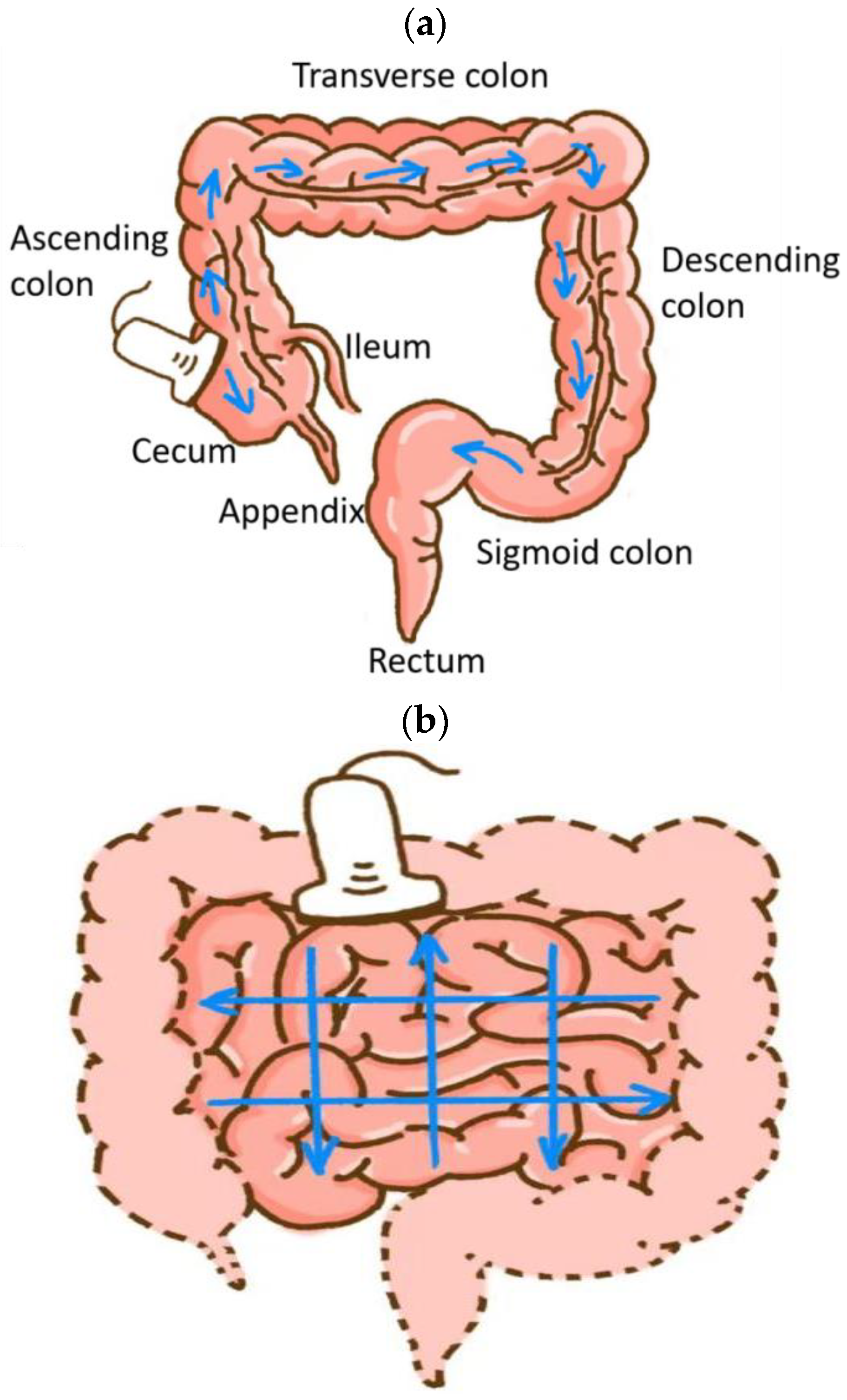 Diagnostics 14 00672 g001