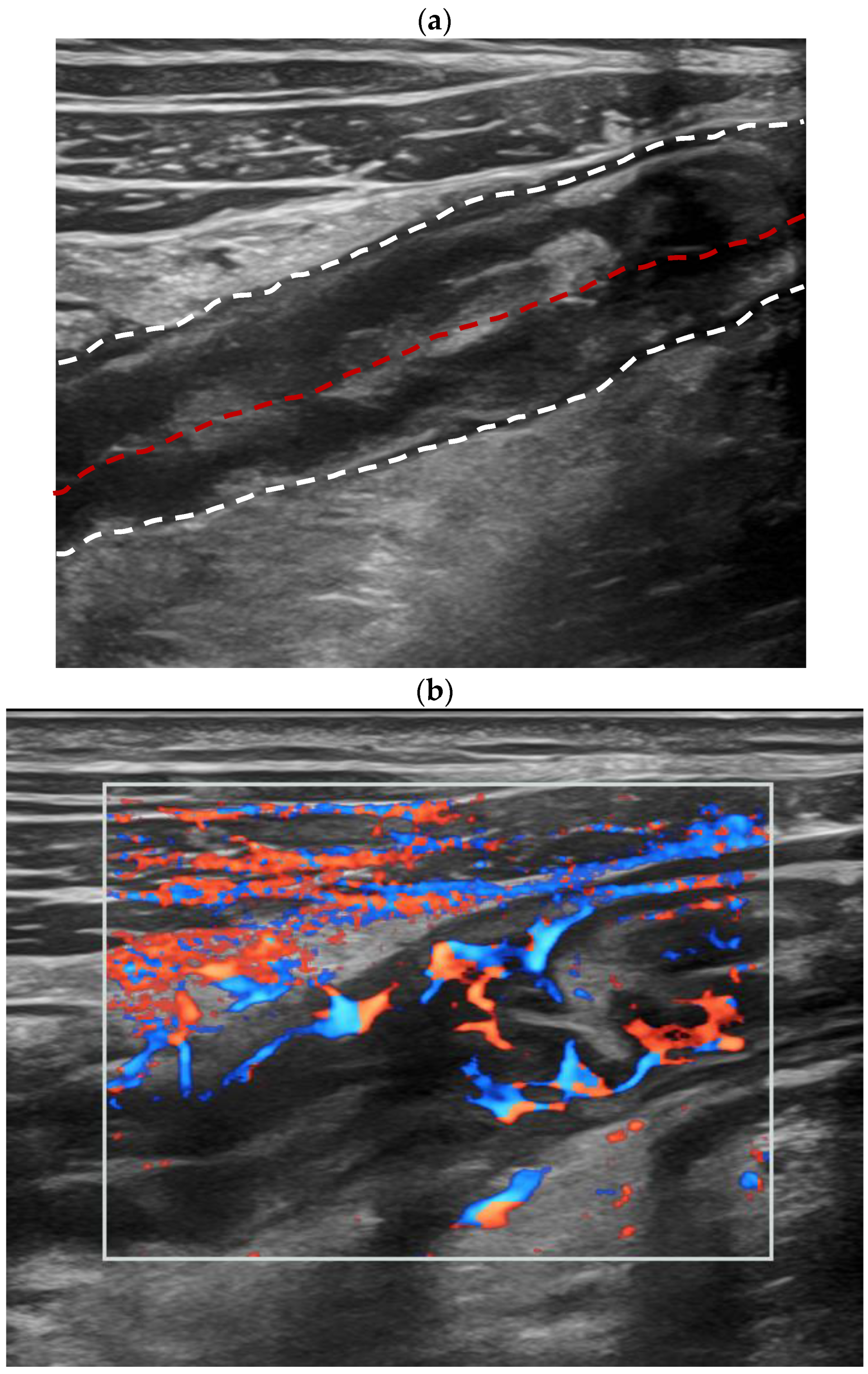 Diagnostics 14 00672 g002a