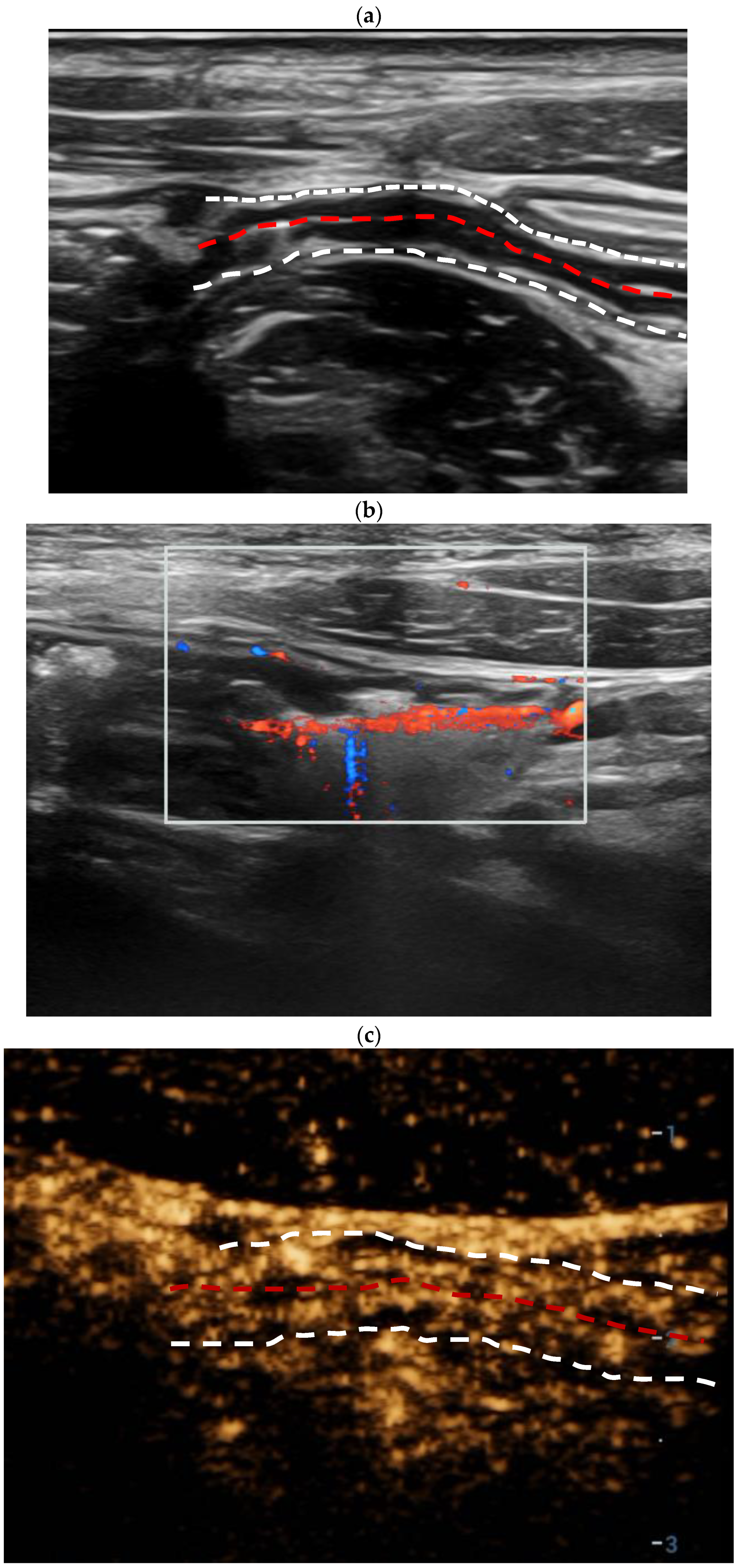Diagnostics 14 00672 g003a