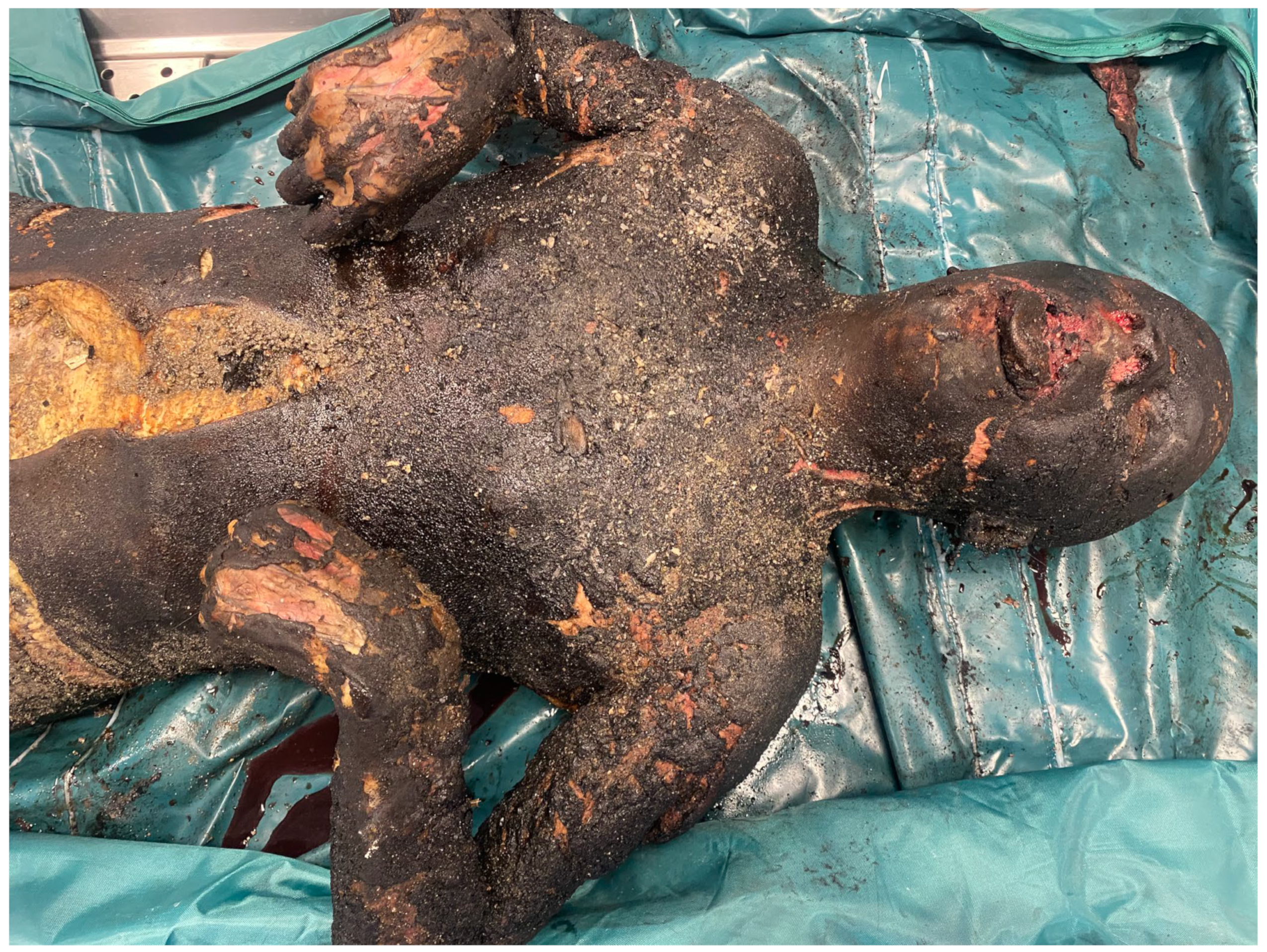 Diagnostics 14 00674 g002 Diagnostics 14 00674 g002