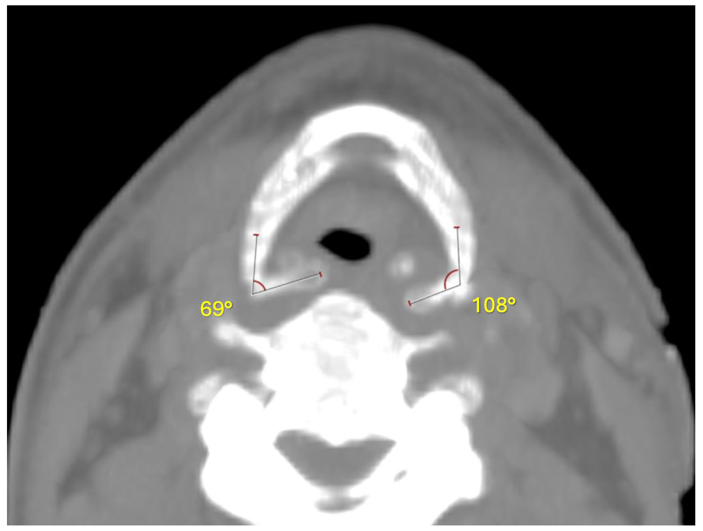 Diagnostics 14 00674 g004 Diagnostics 14 00674 g004