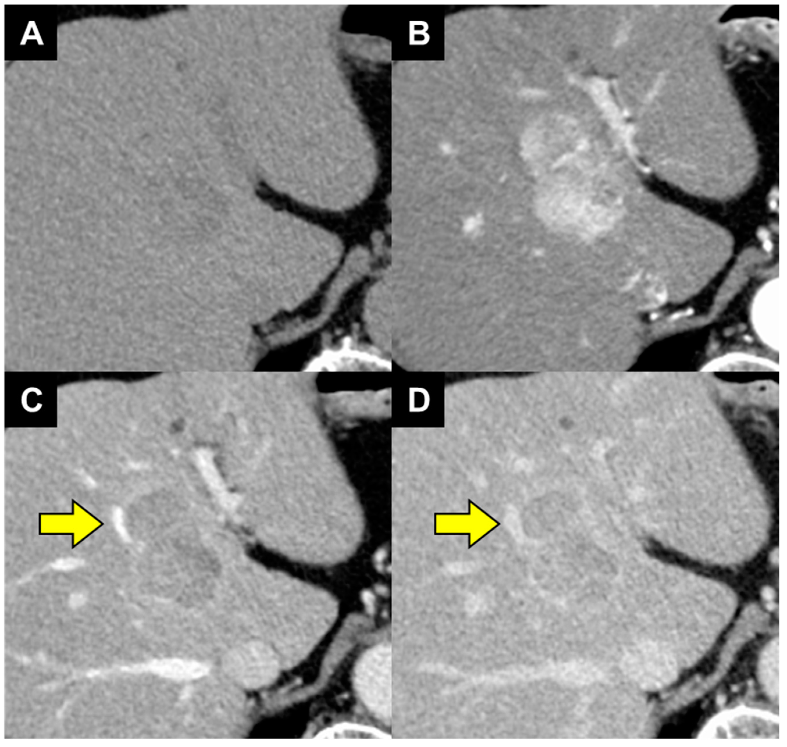 Diagnostics 14 00678 g001