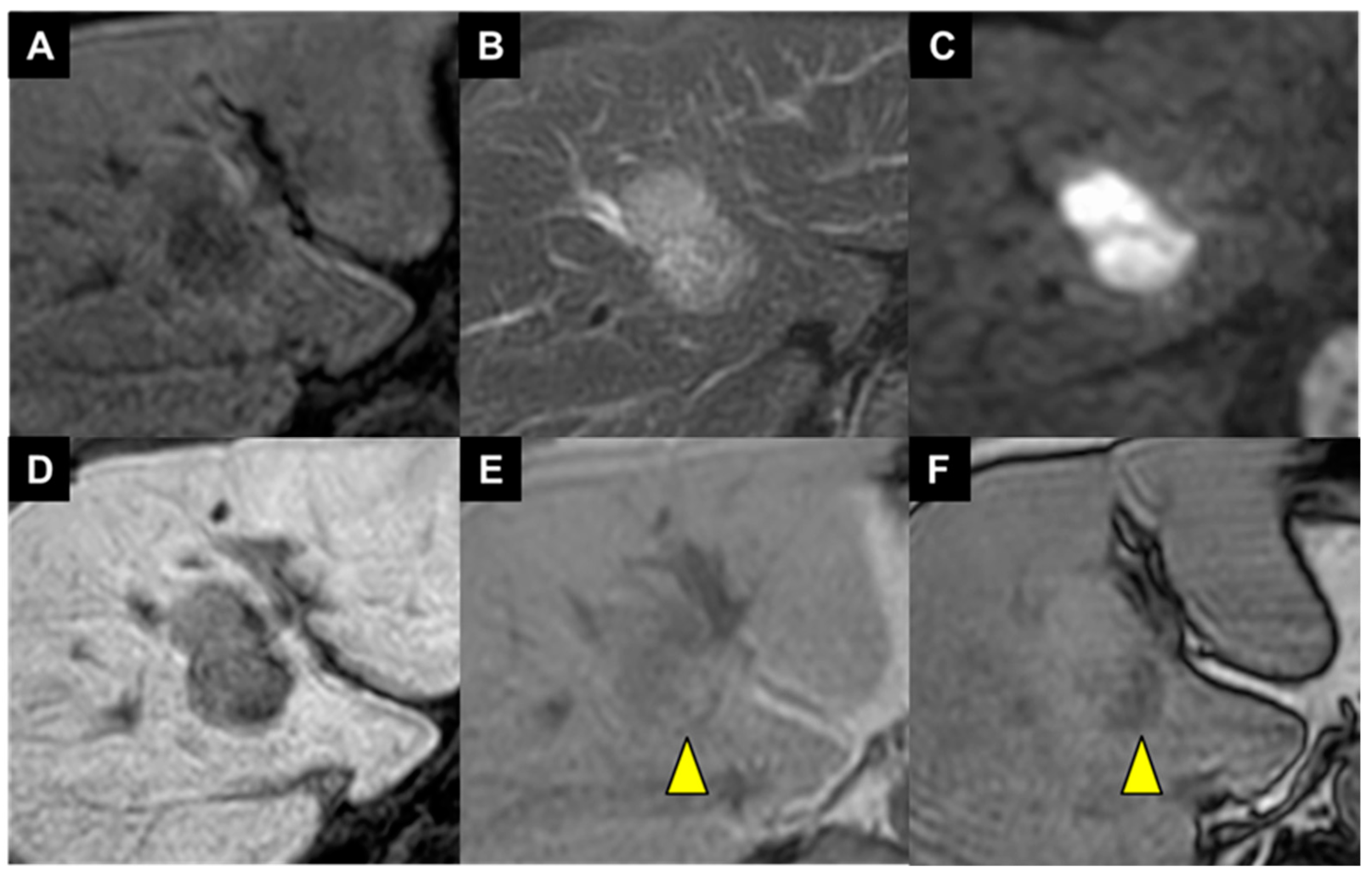 Diagnostics 14 00678 g002
