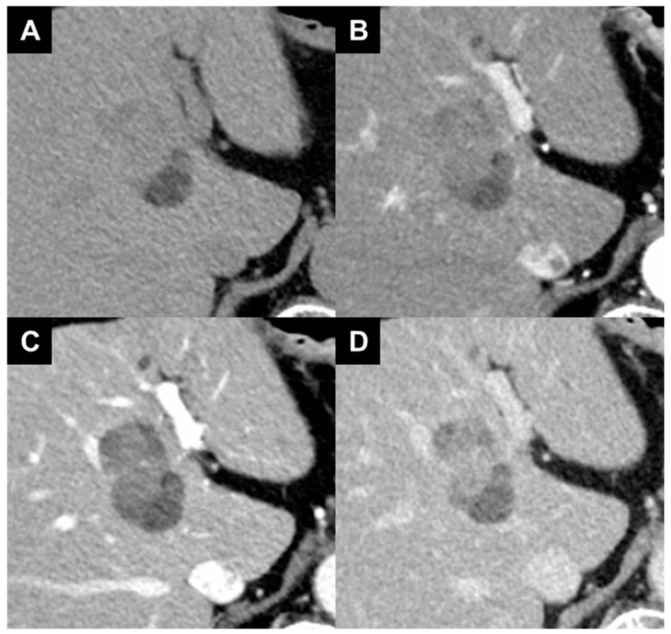Diagnostics 14 00678 g004