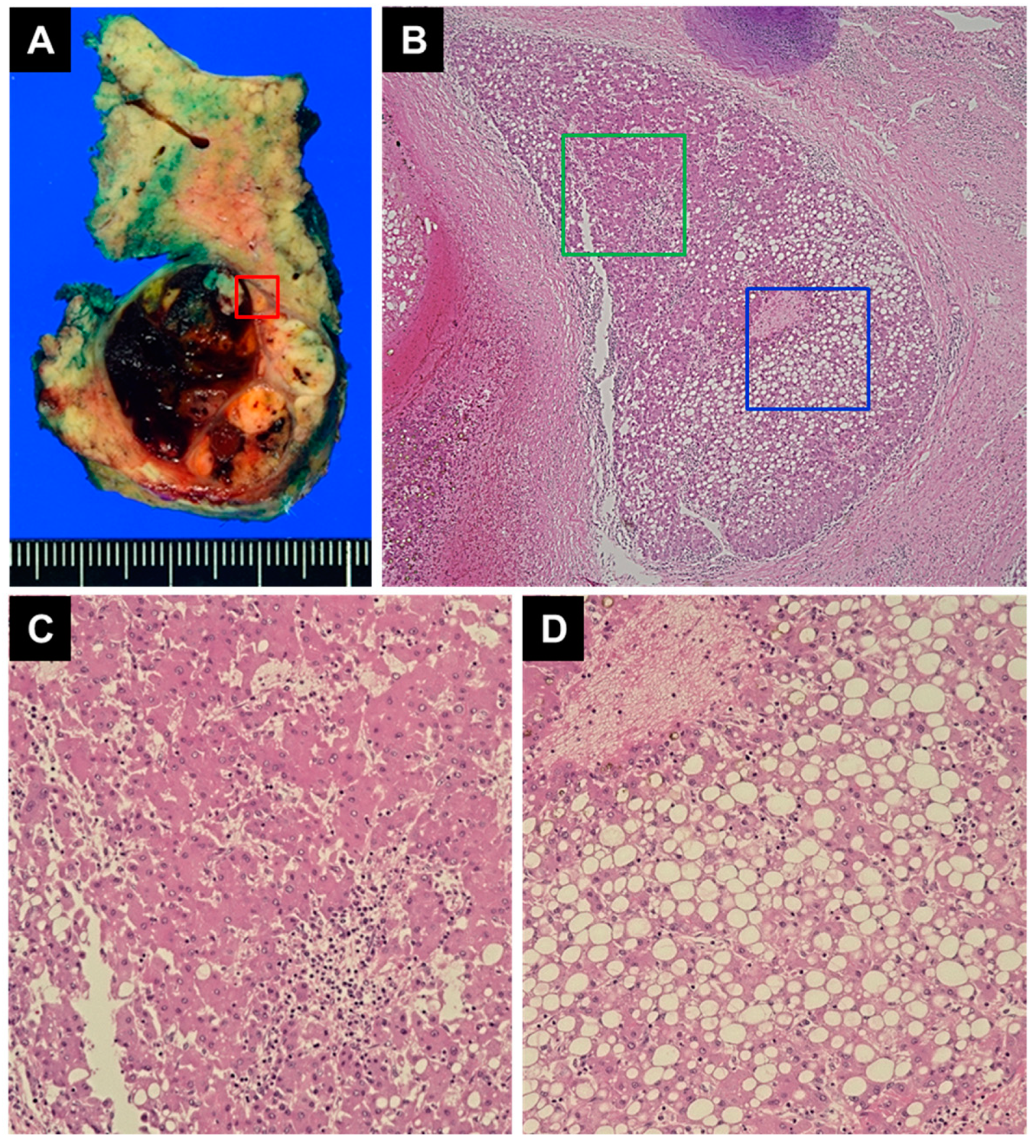 Diagnostics 14 00678 g005
